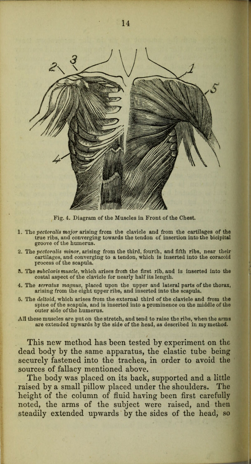 Fig. 4. Diagram of the Muscles iu Front of the Chest. 1. The pectoralis major arising from the clavicle and from the cartilages of the true ribs, and converging towards the tendon of insertion into the bicipital groove of the humerus. 2. The pectoralis minor, arising from the third, fourth, and fifth ribs, near their cartilages, and converging to a tendon, which is inserted into the coracoid process of the scapula. 8. The subclavis muscle, which arises froih the first rib, and is inserted into the costal aspect of the clavicle for nearly half its length. 4. The serratus magnus, placed upon the upper and lateral parts of the thorax, arising from the eight upper ribs, and inserted into the scapula. 5. The deltoid, which arises from the external third of the clavicle and from the spine of the scapula, and is inserted into a prominence on the middle of the outer side of the humerus. All these muscles are put on the stretch, and tend to raise the ribs, when the arms are extended upwards by the side of the head, as described in my method. This new method has been tested by experiment on the dead body by the same apparatus, the elastic tube being securely fastened into the trachea, in order to avoid the sources of fallacy mentioned above. The body was placed on its back, supported and a little raised by a small pillow placed under the shoulders. The height of the column of fluid having been first carefully noted, the arms of the subject were raised, and then steadily extended upwards by the sides of the head, so I