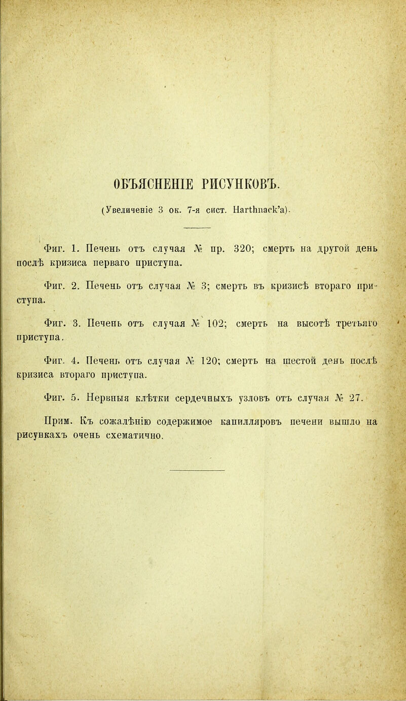 ОБЪЯСНЕНІЕ РИСУНКОВЪ. (Увеличеніе 3 ок. 7-я сист. НагНтаск’а). Фиг. 1. Печень отъ случая № пр. 320; смерть на другой день послѣ кризиса перваго приступа. Фиг. 2. Печень отъ случая № 3; смерть въ кризисѣ втораго при- ступа. Фиг. 3. Печень отъ случая № 102; смерть на высотѣ третьяго приступа. Фиг. 4. Печень отъ случая № 120; смерть на шестой день послѣ кризиса втораго приступа. Фиг. 5. Нервныя клѣтки сердечныхъ узловъ отъ случая № 27. Прим. Къ сожалѣнію содержимое капилляровъ печени вышло на рисункахъ очень схематично. I