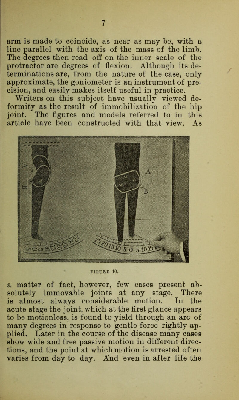 arm is made to coincide, as near as may be, with a line parallel with the axis of the mass of the limb. The degrees then read off on the inner scale of the protractor are degrees of flexion. Although its de- terminations are, from the nature of the case, only approximate, the goniometer is an instrument of pre- cision, and easily makes itself useful in practice. Writers on this subject have usually viewed de- formity as the result of immobilization of the hip joint. The figures and models referred to in this article have been constructed with that view. As FIGURE 10. a matter of fact, however, few cases present ab- solutely immovable joints at any stage. There is almost always considerable motion. In the acute stage the joint, which at the first glance appears to be motionless, is found to yield through an arc of many degrees in response to gentle force rightly ap- plied. Later in the course of the disease many cases show wide and free passive motion in different direc- tions, and the point at which motion is arrested often varies from day to day. And even in after life the