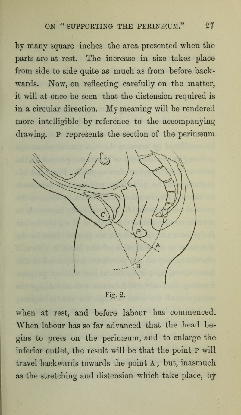 by many square inches the area presented when the parts are at rest. The increase in size takes place from side to side quite as much as from before back- wards. Now, on reflecting carefully on the matter, it will at once be seen that the distension required is in a circular direction. My meaning will be rendered more intelligible by reference to the accompanying drawing. P represents the section of the perinseum when at rest, and before labour has commenced. When labour has so far advanced that the head be- gins to press on the perinseum, and to enlarge the inferior outlet, the result will be that the point P will travel backwards towards the point A; but, inasmuch as the stretching and distension which take place, by