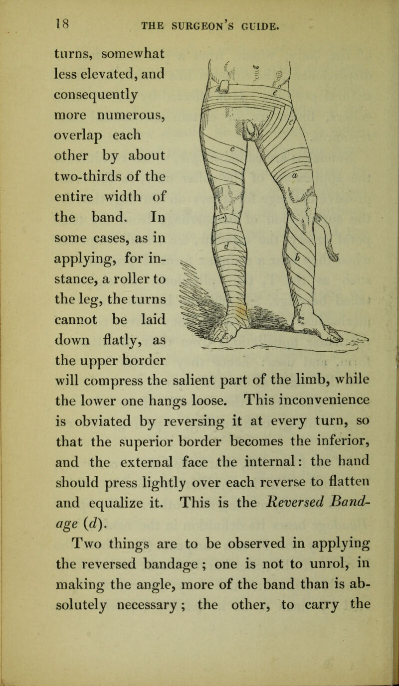 turns, somewhat less elevated, and consequently more numerous, overlap each other by about two-thirds of the entire width of the band. In some cases, as in applying, for in- stance, a roller to the leg,the turns cannot be laid down flatly, as the upper border will compress the salient part of the limb, while the lower one hangs loose. This inconvenience is obviated by reversing it at every turn, so that the superior border becomes the inferior, and the external face the internal: the hand should press lightly over each reverse to flatten and equalize it. This is the Reversed Band- age (d). Two things are to be observed in applying the reversed bandage ; one is not to unrol, in making the angle, more of the band than is ab- solutely necessary; the other, to carry the