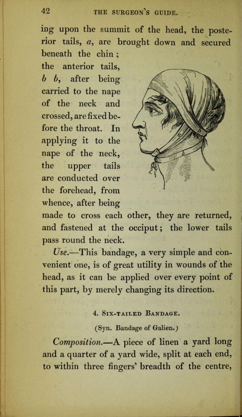 ing upon the summit of the head, the poste- rior tails, are brought down and secured beneath the chin; the anterior tails, b 6, after being carried to the nape of the neck and crossed, are fixed be- fore the throat. In applying it to the nape of the neck. the upper tails \ are conducted over the forehead, from whence, after being made to cross each other, they are returned, and fastened at the occiput; the lower tails pass round the neck. Use.—This bandage, a very simple and con- venient one, is of great utility in wounds of the head, as it can be applied over every point of this part, by merely changing its direction. 4. Six-tailed Bandage. (Syn. Bandage of Galien.) Composition.—A piece of linen a yard long and a quarter of a yard wide, split at each end, to within three fingers’ breadth of the centre.