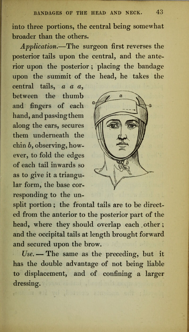 into three portions, the central being somewhat broader than the others. Application,—The surgeon first reverses the posterior tails upon the central, and the ante- rior upon the posterior; placing the bandage upon the summit of the head, he takes the central tails, a a between the thumb and fingers of each hand, and passing them along the ears, secures them underneath the chin 6, observing, how- ever, to fold the edges of each tail inwards so as to give it a triangu- lar form, the base cor- responding to the un- split portion ; the frontal tails are to be direct- ed from the anterior to the posterior part of the head, where they should overlap each.other; and the occipital tails at length brought forward and secured upon the brow. Use, — The same as the preceding, but it has the double advantage of not being liable to displacement, and of confining a larger dressing.