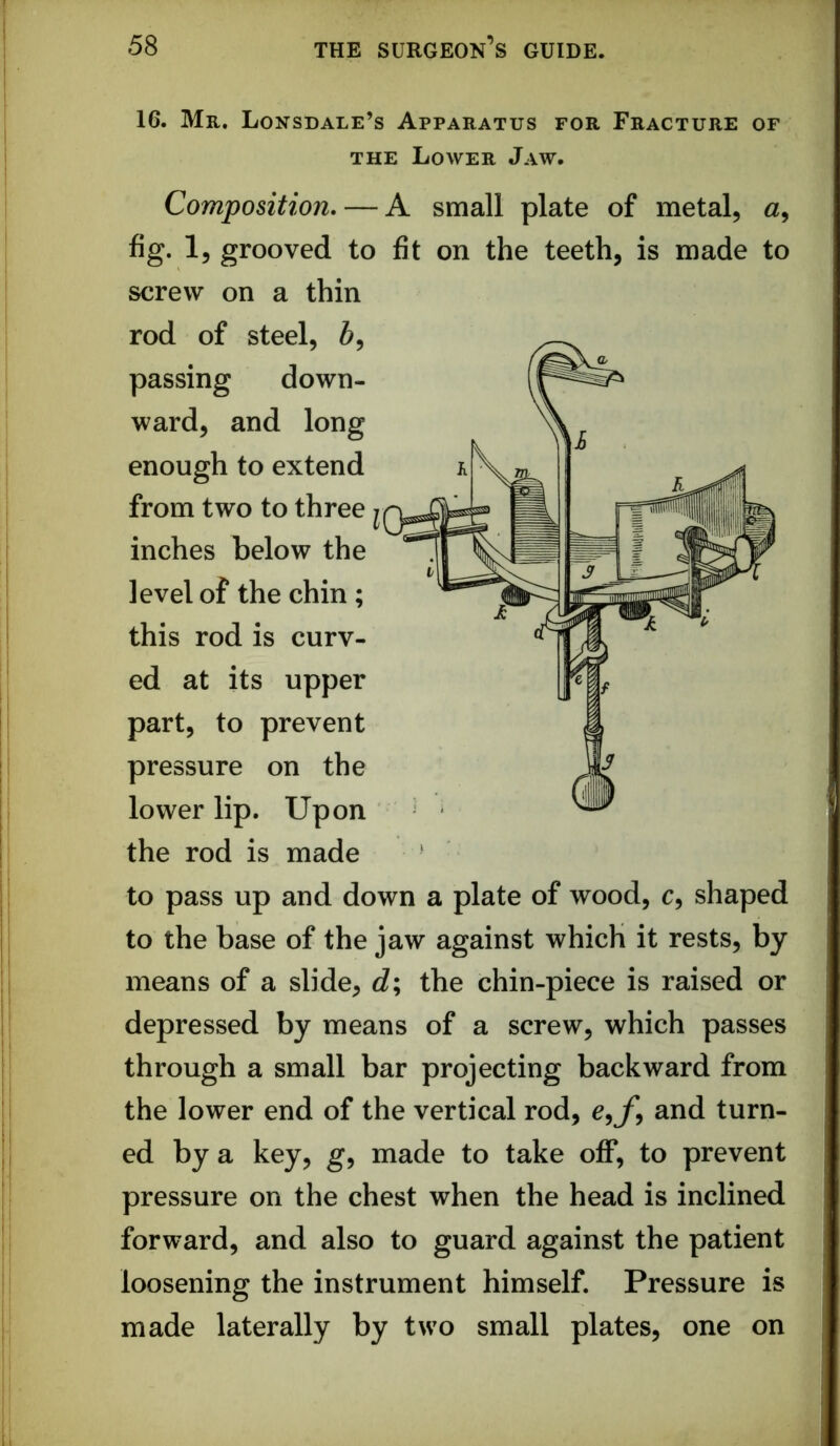 16. Mr. Lonsdale’s Apparatus for Fracture of THE Lower Jaw. Composition. — A small plate of metal, fig. 1, grooved to fit on the teeth, is made to screw on a thin rod of steel, 5, passing down- ward, and long enough to extend from two to three | inches below the level of the chin ; this rod is curv- ed at its upper part, to prevent pressure on the lower lip. Upon the rod is made ’ to pass up and down a plate of wood, c, shaped to the base of the jaw against which it rests, by means of a slide, d\ the chin-piece is raised or depressed by means of a screw, which passes through a small bar projecting backward from the lower end of the vertical rod, c,/*, and turn- ed by a key, g, made to take off, to prevent pressure on the chest when the head is inclined forward, and also to guard against the patient loosening the instrument himself. Pressure is made laterally by two small plates, one on