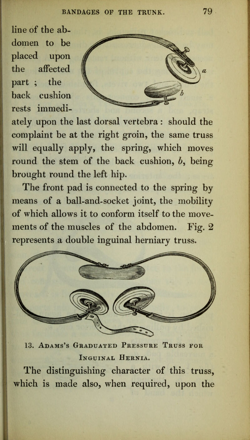 line of the ab- domen to be placed upon the affected part ; the back cushion rests immedi- ately upon the last dorsal vertebra : should the complaint be at the right groin, the same truss will equally apply, the spring, which moves round the stem of the back cushion, 6, being brought round the left hip. The front pad is connected to the spring by means of a ball-and-socket joint, the mobility of which allows it to conform itself to the move- ments of the muscles of the abdomen. Fig. 2 represents a double inguinal herniary truss. 13. Adams’s Graduated Pressure Truss for Inguinal Hernia. The distinguishing character of this truss, which is made also, when required, upon the