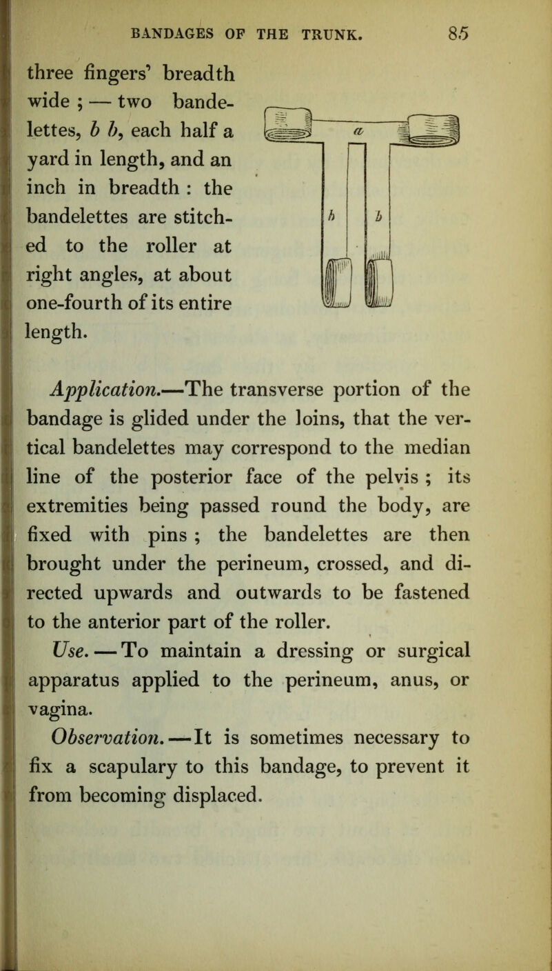 three fingers’ breadth wide ; — two bande- lettesj h 5, each half a yard in length, and an inch in breadth : the bandelettes are stitch- ed to the roller at right angles, at about one-fourth of its entire length. Application.—The transverse portion of the bandage is glided under the loins, that the ver- tical bandelettes may correspond to the median line of the posterior face of the pelvis ; its extremities being passed round the body, are fixed with pins ; the bandelettes are then brought under the perineum, crossed, and di- rected upwards and outwards to be fastened to the anterior part of the roller. Use. — To maintain a dressing or surgical apparatus applied to the perineum, anus, or vagina. Observation.—It is sometimes necessary to fix a scapulary to this bandage, to prevent it from becoming displaced.