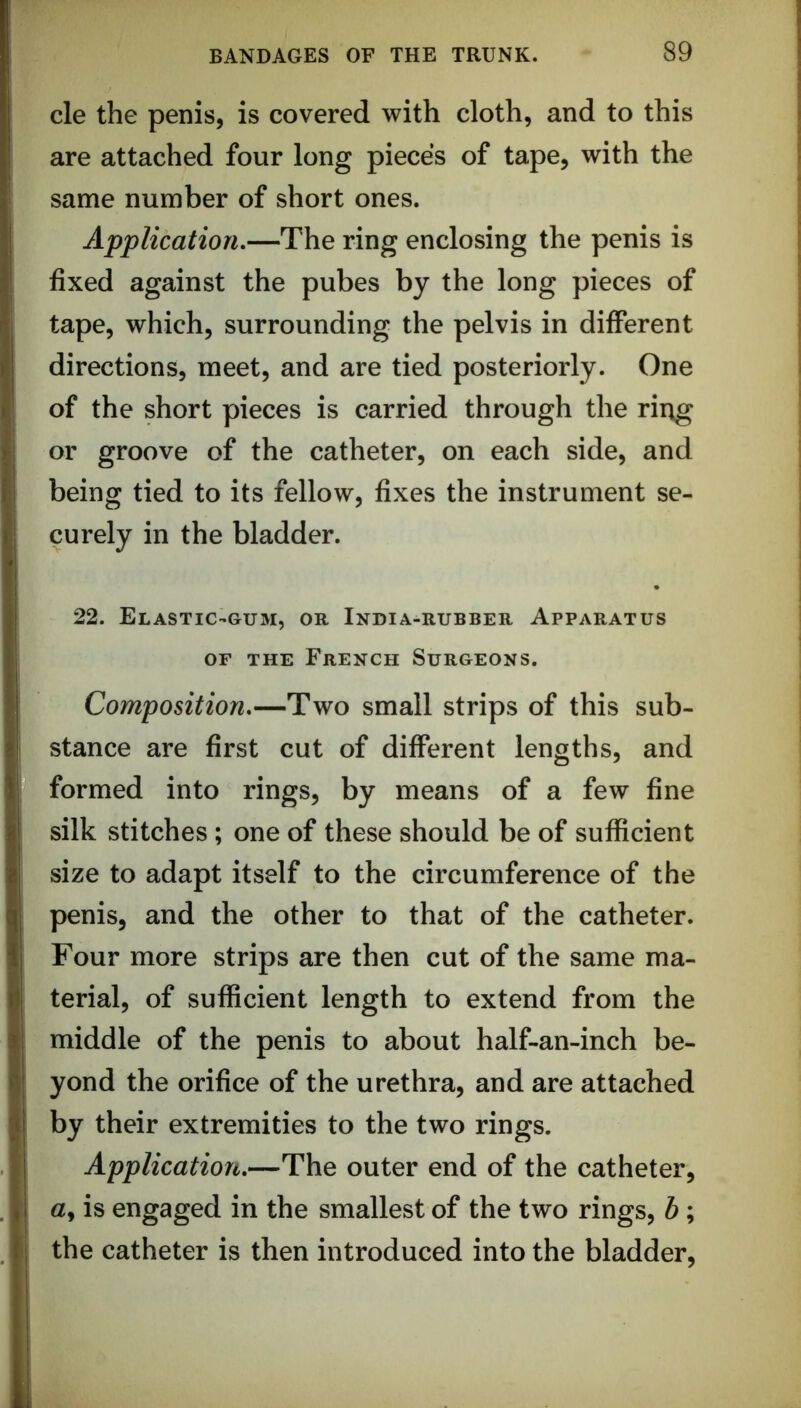 cle the penis, is covered with cloth, and to this are attached four long pieces of tape, with the same number of short ones. Application.—The ring enclosing the penis is fixed against the pubes by the long pieces of tape, which, surrounding the pelvis in different directions, meet, and are tied posteriorly. One of the short pieces is carried through the rii\g or groove of the catheter, on each side, and being tied to its fellow, fixes the instrument se- curely in the bladder. 22. Elastic-gum, or India-rubber Apparatus OF THE French Surgeons. Composition.—Two small strips of this sub- stance are first cut of different lengths, and formed into rings, by means of a few fine silk stitches ; one of these should be of sufficient size to adapt itself to the circumference of the penis, and the other to that of the catheter. Four more strips are then cut of the same ma- terial, of sufficient length to extend from the middle of the penis to about half-an-inch be- yond the orifice of the urethra, and are attached by their extremities to the two rings. Application.—The outer end of the catheter, a, is engaged in the smallest of the two rings, b ; the catheter is then introduced into the bladder.