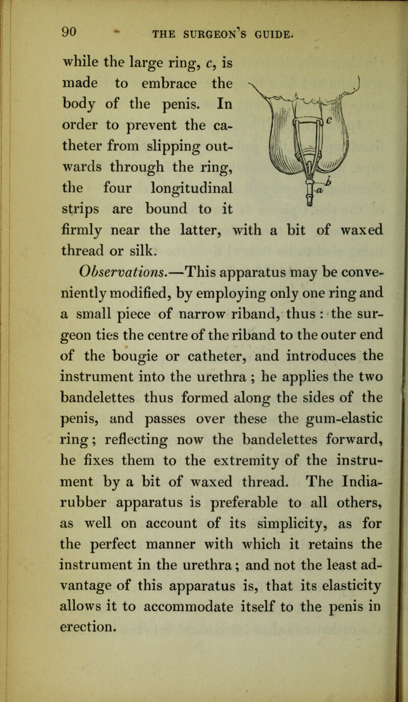 while the large ring, c, is made to embrace the body of the penis. In order to prevent the ca- theter from slipping out- wards through the ring, the four longitudinal strips are bound to it firmly near the latter, with a bit of waxed thread or silk. Observations*—This apparatus may be conve- niently modified, by employing only one ring and a small piece of narrow riband, thus : the sur- geon ties the centre of the riband to the outer end of the bougie or catheter, and introduces the instrument into the urethra ; he applies the two bandelettes thus formed along the sides of the penis, and passes over these the gum-elastic ring; reflecting now the bandelettes forward, he fixes them to the extremity of the instru- ment by a bit of waxed thread. The India- rubber apparatus is preferable to all others, as well on account of its simplicity, as for the perfect manner with which it retains the instrument in the urethra; and not the least ad- vantage of this apparatus is, that its elasticity allows it to accommodate itself to the penis in erection.