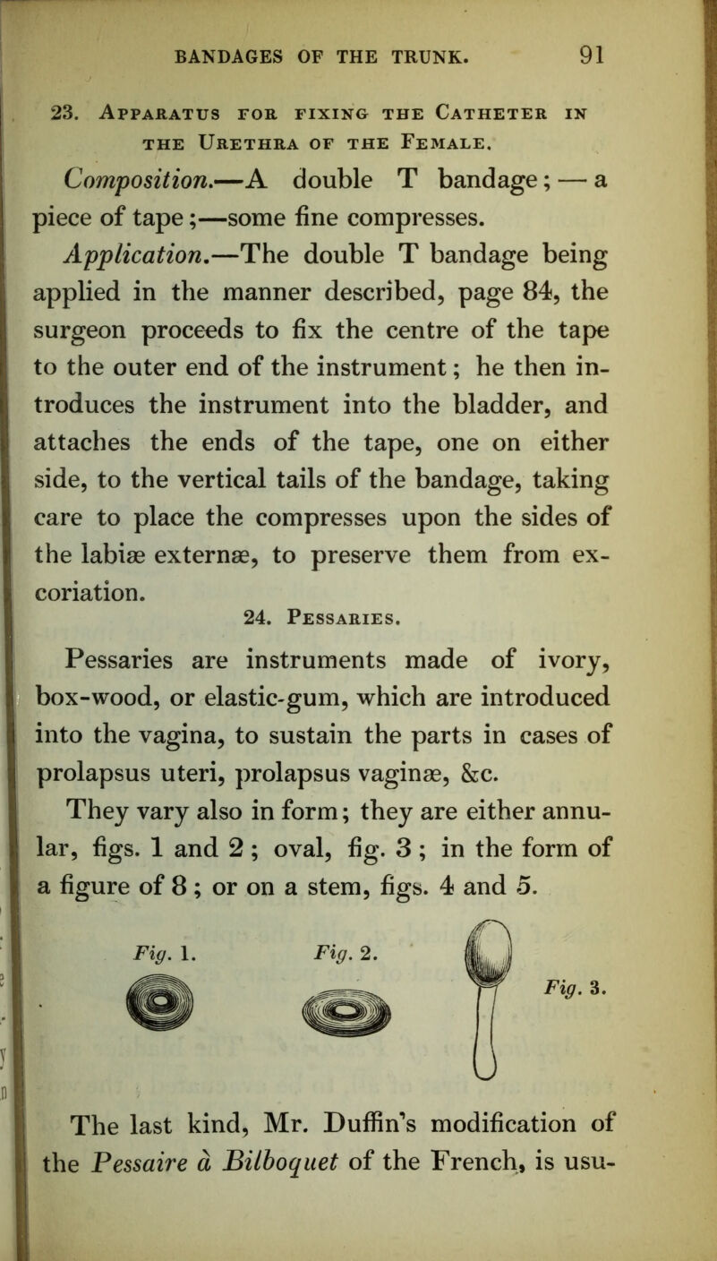 23. Apparatus for fixing the Catheter in THE Urethra of the Female, Composition,—A double T bandage; — a piece of tape;—some fine compresses. Application.—The double T bandage being applied in the manner described, page 84, the surgeon proceeds to fix the centre of the tape to the outer end of the instrument; he then in- troduces the instrument into the bladder, and attaches the ends of the tape, one on either side, to the vertical tails of the bandage, taking care to place the compresses upon the sides of the labiae externae, to preserve them from ex- coriation. 24. Pessaries. Pessaries are instruments made of ivory, box-wood, or elastic-gum, which are introduced into the vagina, to sustain the parts in cases of prolapsus uteri, prolapsus vaginae, &c. They vary also in form; they are either annu- lar, figs. 1 and 2; oval, fig. 3 ; in the form of a figure of 8; or on a stem, figs. 4 and 5. The last kind, Mr. Puffin’s modification of the Pessaire d Bilboquet of the French, is usu-