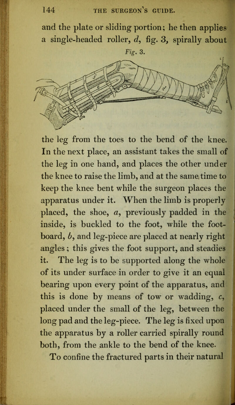 and the plate or sliding portion; he then applies a single-headed roller^ d, fig. 3, spirally about Fig. 3. In the next place, an assistant takes the small of the leg in one hand, and places the other under the knee to raise the limb, and at the same time to keep the knee bent while the surgeon places the apparatus under it. When the limb is properly placed, the shoe, a, previously padded in the i inside, is buckled to the foot, while the foot- board, 6, and leg-piece are placed at nearly right angles; this gives the foot support, and steadies it. The leg is to be supported along the whole of its under surface in order to give it an equal bearing upon every point of the apparatus, and this is done by means of tow or wadding, c, placed under the small of the leg, between the long pad and the leg-piece. The leg is fixed upon the apparatus by a roller carried spirally round both, from the ankle to the bend of the knee. To confine the fractured parts in their natural