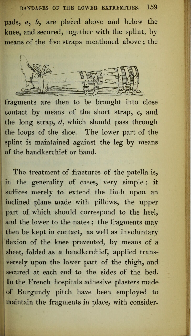 pads, a, 5, are placed above and below the knee, and secured, together with the splint, by means of the five straps mentioned above; the fragments are then to be brought into close contact by means of the short strap, c, and the long strap, c?, which should pass through 1 the loops of the shoe. The lower part of the I splint is maintained against the leg by means I of the handkerchief or band. I The treatment of fractures of the patella is, ! in the generality of cases, very simple; it suffices merely to extend the limb upon an inclined plane made with pillows, the upper I part of which should correspond to the heel, I and the lower to the nates ; the fragments may then be kept in contact, as well as involuntary I flexion of the knee prevented, by means of a I sheet, folded as a handkerchief, applied trans- I versely upon the lower part of the thigh, and I secured at each end to the sides of the bed. I In the French hospitals adhesive plasters made of Burgundy pitch have been employed to maintain the fragments in place, with consider-