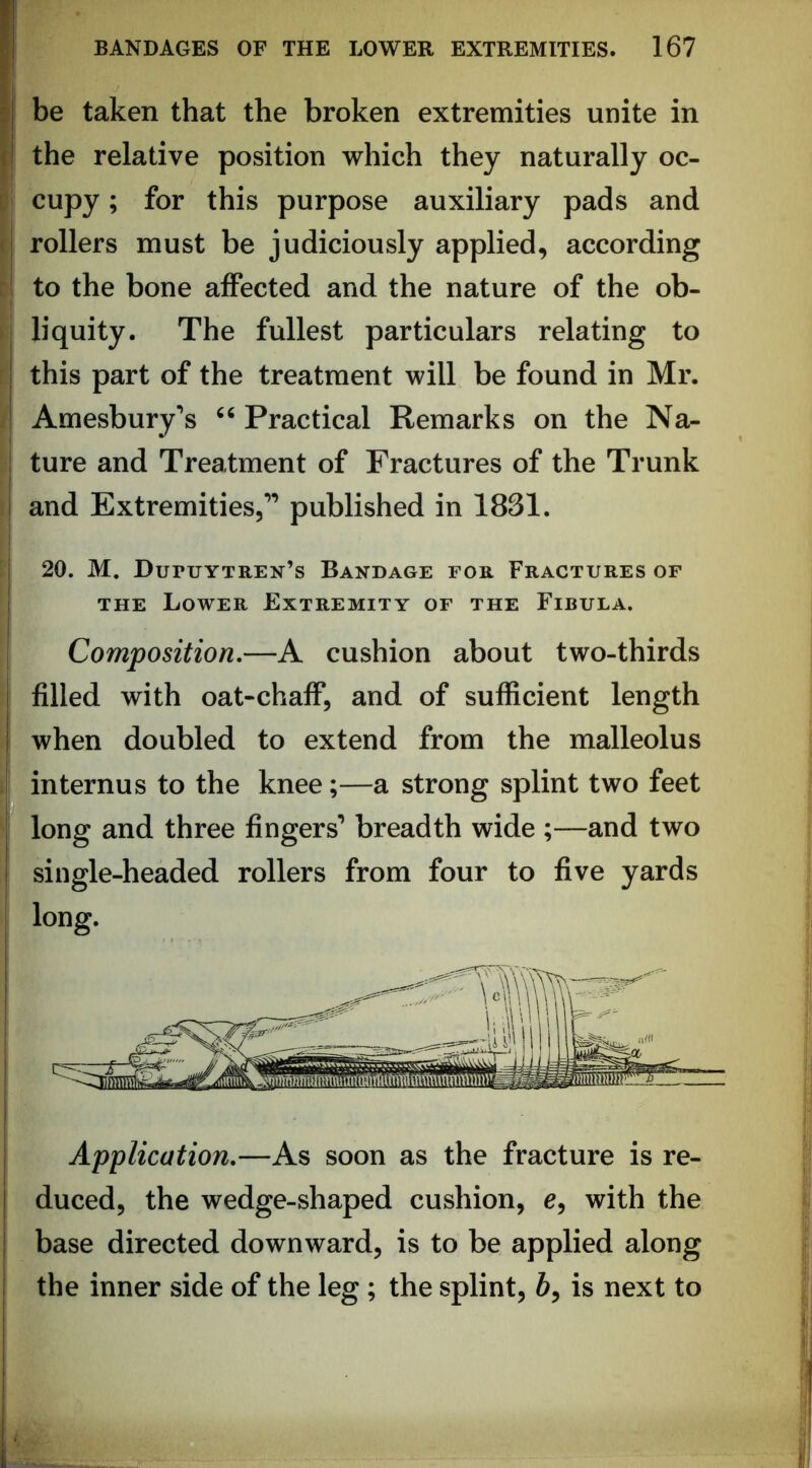 be taken that the broken extremities unite in the relative position which they naturally oc- cupy ; for this purpose auxiliary pads and rollers must be judiciously applied, according to the bone affected and the nature of the ob- liquity. The fullest particulars relating to this part of the treatment will be found in Mr. Amesbury's Practical Remarks on the Na- ture and Treatment of Fractures of the Trunk and Extremities,’’ published in 1831. 20. M. DuruYTREN’s Bandage for Fractures of THE Lower Extremity of the Fibula. Composition,—A cushion about two-thirds filled with oat-chaff, and of sufficient length when doubled to extend from the malleolus internus to the knee;—a strong splint two feet long and three fingers’ breadth wide ;—and two single-headed rollers from four to five yards long. Application,—As soon as the fracture is re- duced, the wedge-shaped cushion, e, with the base directed downward, is to be applied along the inner side of the leg; the splint, 6, is next to