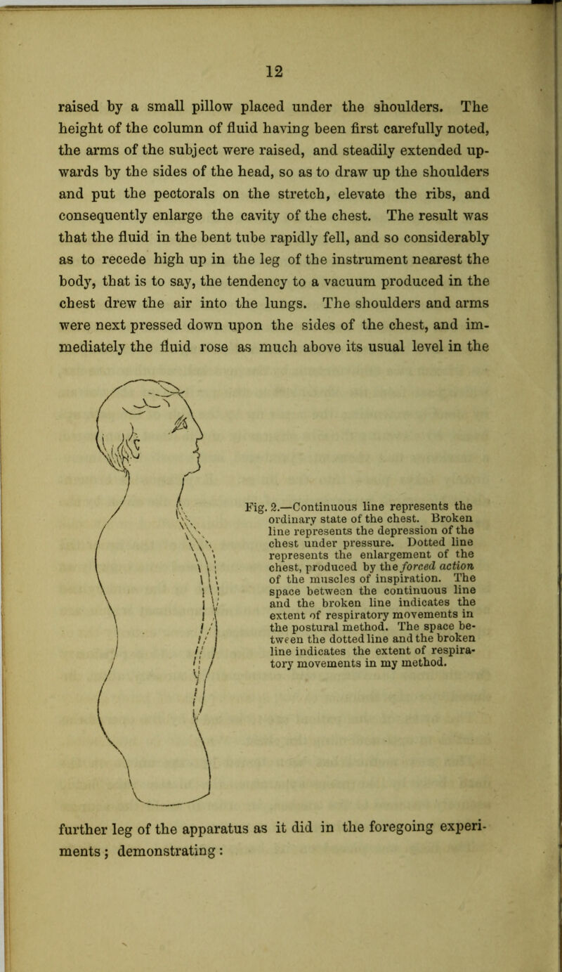 raised by a small pillow placed under the shoulders. The height of the column of fluid having been first carefully noted, the arms of the subject were raised, and steadily extended up- wards by the sides of the head, so as to draw up the shoulders and put the pectorals on the stretch, elevate the ribs, and consequently enlarge the cavity of the chest. The result was that the fluid in the bent tube rapidly fell, and so considerably as to recede high up in the leg of the instrument nearest the bodjr, that is to say, the tendency to a vacuum produced in the chest drew the air into the lungs. The shoulders and arms were next pressed down upon the sides of the chest, and im- mediately the fluid rose as much above its usual level in the Fig. 2.—Continuous line represents the ordinary state of the chest. Broken line represents the depression of the chest under pressure. Dotted line represents the enlargement of the chest, produced by the forced action of the muscles of inspiration. The space between the continuous line and the broken line indicates the extent of respiratory movements in the postural method. The space be- tween the dotted line and the broken line indicates the extent of respira- tory movements in my method. further leg of the apparatus as it did in the foregoing experi- ments ; demonstrating: