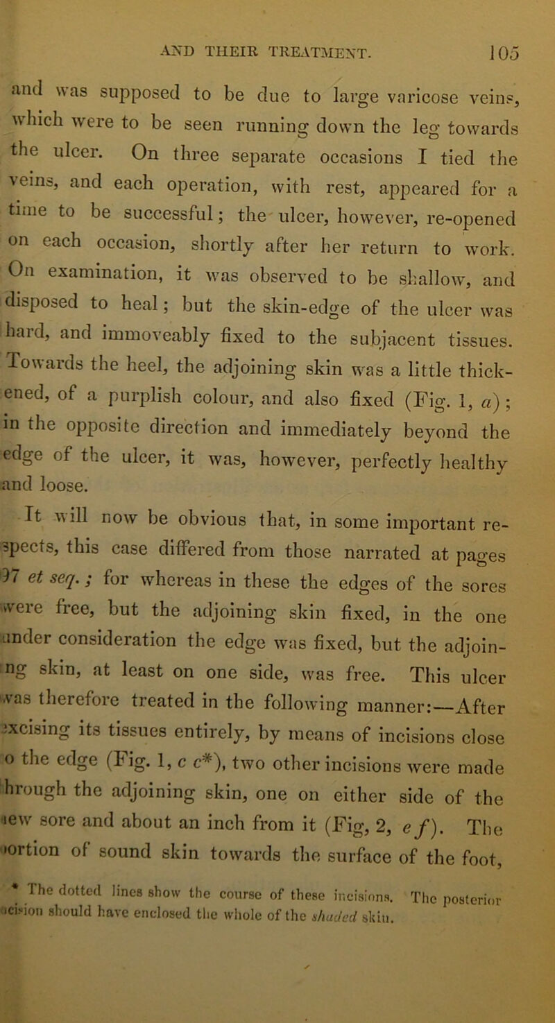 and was supposed to be due to large varicose veins, which were to be seen running down the leg towards the ulcer. On three separate occasions I tied the \eins, and each operation, with rest, appeared for a time to be successful; the ulcer, however, re-opened on each occasion, shortly after her return to work. On examination, it was observed to be shallow, and disposed to heal; but the skin-edge of the ulcer was hard, and immoveably fixed to the subjacent tissues. Towards the heel, the adjoining skin was a little thick- ened, of a purplish colour, and also fixed (Fig. 1, a) ; in the opposite direction and immediately beyond the edge of the ulcer, it was, however, perfectly healthy and loose. Tt will now be obvious that, in some important re- spects, this case differed from those narrated at pages d7 et seq.; for whereas in these the edges of the sores were free, but the adjoining skin fixed, in the one under consideration the edge was fixed, but the adjoin- ng skin, at least on one side, was free. This ulcer -vas therefoie treated in the following manner:—After :xcising its tissues entirely, by means of incisions close o the edge (fig. 1, c c#), two other incisions were made hrough the adjoining skin, one on either side of the iew sore and about an inch from it (Fig, 2, e f). The •ortion of sound skin towards the surface of the foot, * The dotted lines show the course of these incisions. The posterior ocision should have enclosed the whole of the shaded skin.