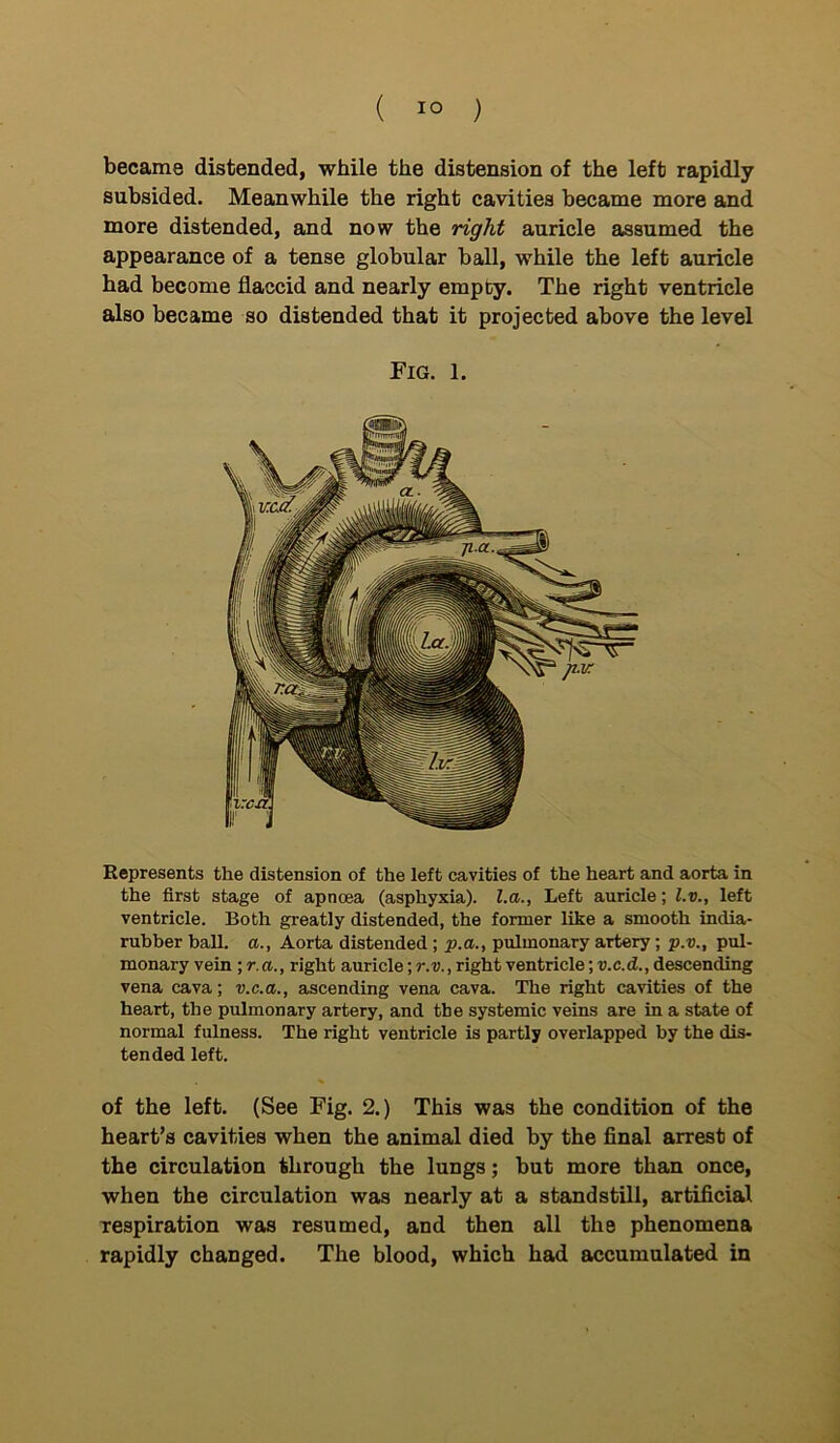 became distended, while the distension of the left rapidly subsided. Meanwhile the right cavities became more and more distended, and now the right auricle assumed the appearance of a tense globular ball, while the left auricle had become flaccid and nearly empty. The right ventricle also became so distended that it projected above the level Represents the distension of the left cavities of the heart and aorta in the first stage of apnoea (asphyxia), l.a., Left auricle; l.v., left ventricle. Both greatly distended, the former like a smooth india- rubber ball, a., Aorta distended; p.a., pulmonary artery; p.v., pul- monary vein ;r.a., right auricle ;r.v., right ventricle; v.c.d., descending vena cava; v.c.a., ascending vena cava. The right cavities of the heart, the pulmonary artery, and the systemic veins are in a state of normal fulness. The right ventricle is partly overlapped by the dis- tended left. of the left. (See Fig. 2.) This was the condition of the heart’s cavities when the animal died by the final arrest of the circulation through the lungs; but more than once, when the circulation was nearly at a standstill, artificial respiration was resumed, and then all the phenomena rapidly changed. The blood, which had accumulated in