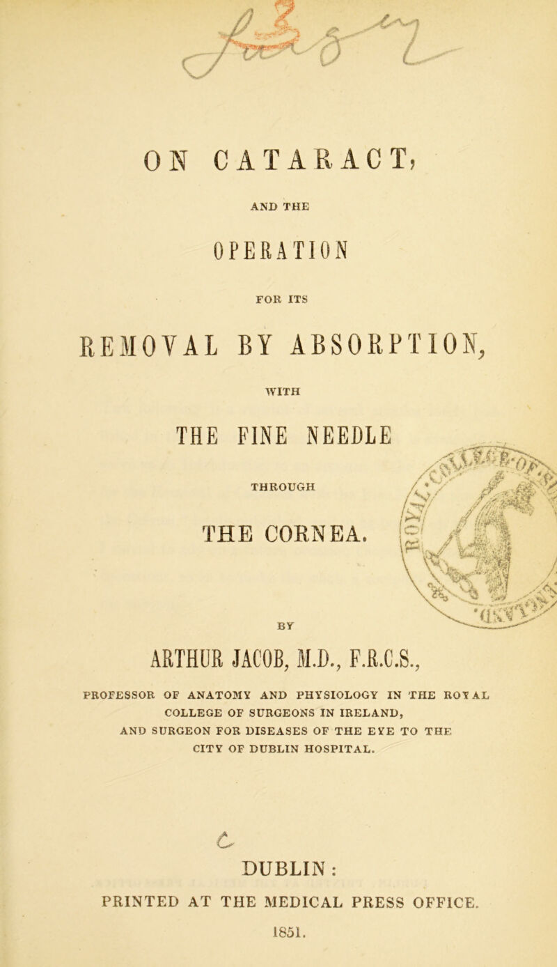 ON CATARACT, AND THE OPERATION FOR ITS REMOVAL BY ABSORPTION, WITH THE FINE NEEDLE THROUGH THE CORNEA. BY ARTHUR JACOB, M.D., F.R.C.S., PROFESSOR OF ANATOMY AND PHYSIOLOGY IN THE ROYAL COLLEGE OF SURGEONS IN IRELAND, AND SURGEON FOR DISEASES OF THE EYE TO THE CITY OF DUBLIN HOSPITAL. 6 DUBLIN : PRINTED AT THE MEDICAL PRESS OFFICE. 1851.