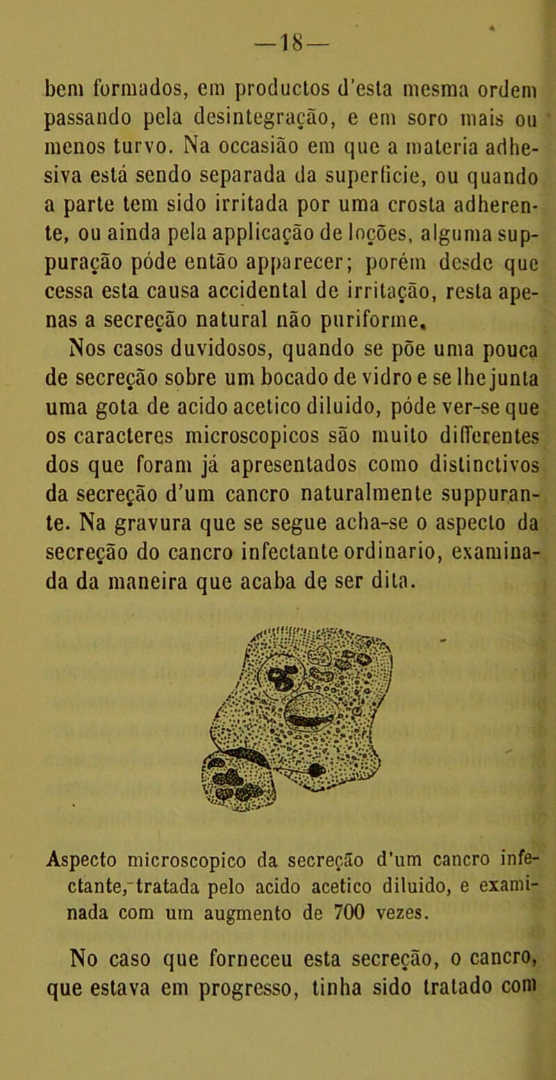 —18 — bem formados, em productos d’esla mesma ordem passando pela desintegração, e em soro mais ou menos turvo. Na occasião em que a matéria adhe- siva está sendo separada da superíicie, ou quando a parte tem sido irritada por uma crosta adheren- te, ou ainda pela applicação de loções, alguma sup- puração póde então apparecer; porém desde que cessa esta causa accidcntal de irritação, resta ape- nas a secreção natural não puriforme. Nos casos duvidosos, quando se põe uma pouca de secreção sobre um bocado de vidro e se lhe junta uma gota de acido acético diluido, póde ver-se que os caracteres microscopicos são muito diíTerentes dos que foram já apresentados como distinctivos da secreção d’um cancro naturalmente suppuran- te. Na gravura que se segue acha-se o aspecto da secreção do cancro infectante ordinário, examina- da da maneira que acaba de ser dita. Aspecto microscopico da secreção d’um cancro infe- ctante, tratada pelo acido acético diluido, e exami- nada com um augmento de 700 vezes. No caso que forneceu esta secreção, o cancro, que estava em progresso, tinha sido tratado com