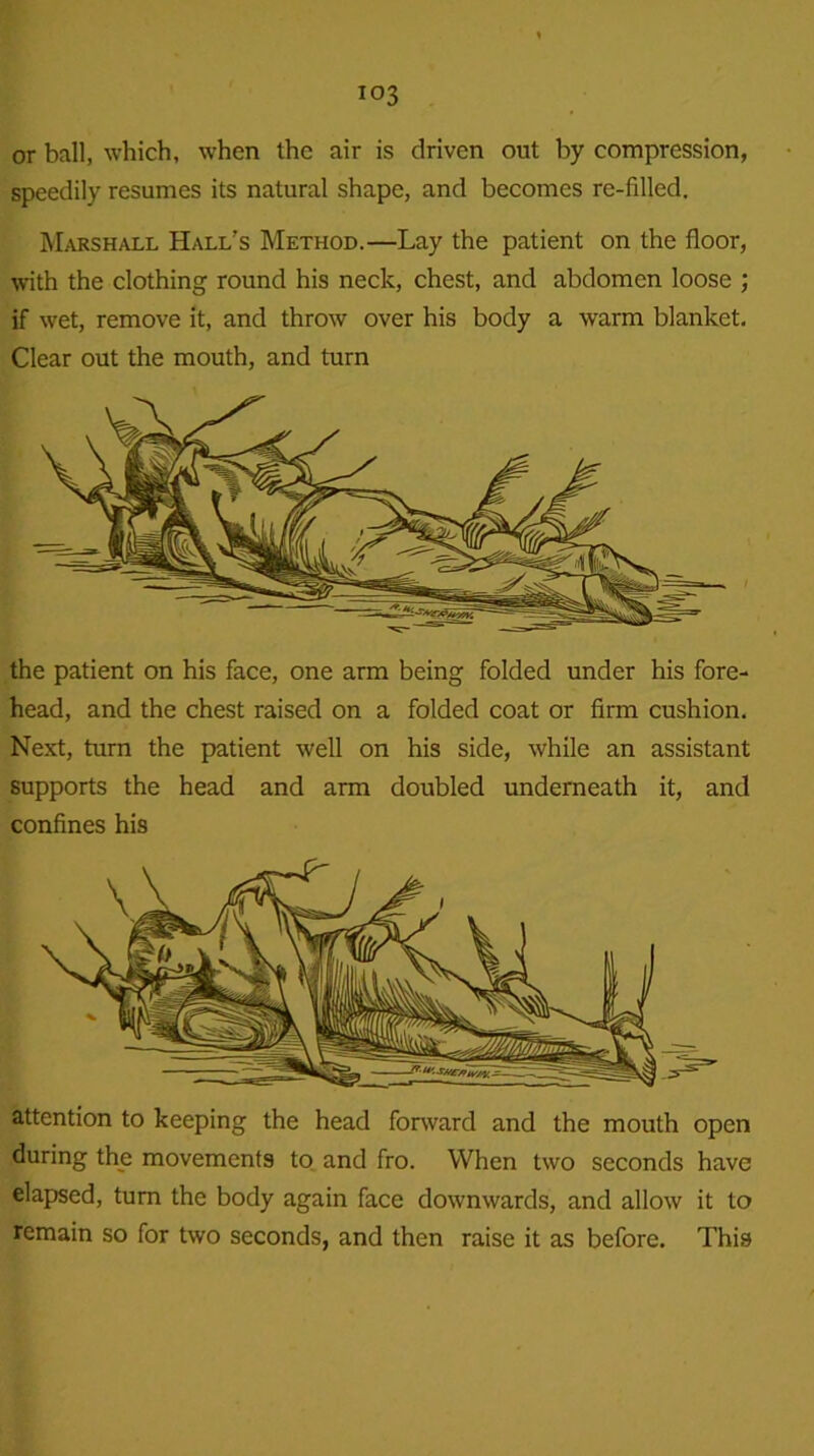 io3 or ball, which, when the air is driven out by compression, speedily resumes its natural shape, and becomes re-filled. Marshall Hall's Method.—Lay the patient on the floor, with the clothing round his neck, chest, and abdomen loose ; if wet, remove it, and throw over his body a warm blanket. Clear out the mouth, and turn attention to keeping the head forward and the mouth open during the movements to and fro. When two seconds have elapsed, turn the body again face downwards, and allow it to remain so for two seconds, and then raise it as before. This the patient on his face, one arm being folded under his fore- head, and the chest raised on a folded coat or firm cushion. Next, turn the patient well on his side, while an assistant supports the head and arm doubled underneath it, and confines his