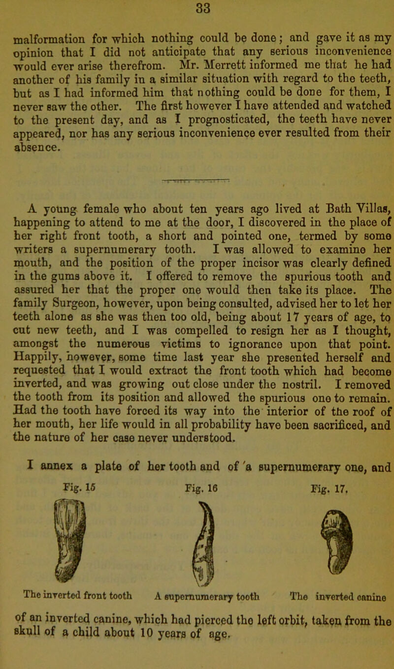 malformation for which nothing could be done; and gave it as my opinion that I did not anticipate that any serious inconvenience would ever arise therefrom. Mr. Merrett informed me that he had another of his family in a similar situation with regard to the teeth, but as I had informed him that nothing could be done for them, I never saw the other. The first however I have attended and watched to the present day, and as I prognosticated, the teeth have never appeared, nor has any serious inconvenience ever resulted from their absence. A young female who about ten years ago lived at Bath Villas, happening to attend to me at the door, I discovered in the place of her right front tooth, a short and pointed one, termed by some writers a supernumerary tooth. I was allowed to examine her mouth, and the position of the proper incisor was clearly defined in the gums above it. I offered to remove the spurious tooth and assured her that the proper one would then take its place. The family Surgeon, however, upon being consulted, advised her to let her teeth alone as she was then too old, being about 17 years of age, to cut new teeth, and I was compelled to resign her as I thought, amongst the numerous victims to ignorance upon that point. Happily, however, some time last year she presented herself and requested that I would extract the front tooth which had become inverted, and was growing out close under the nostril. I removed the tooth from its position and allowed the spurious one to remain. Had the tooth have forced its way into the interior of the roof of her mouth, her life would in all probability have been sacrificed, and the nature of her case never understood. I annex a plate of her tooth and of 'a supernumerary one, and Fig. 15 Fig. 16 Fig. 17. fPH Jm w 9 w The inverted front tooth A supernumerary tooth The inverted canine of an inverted canine, which had pierced the left orbit, taken from the skull of a child about 10 years of age.