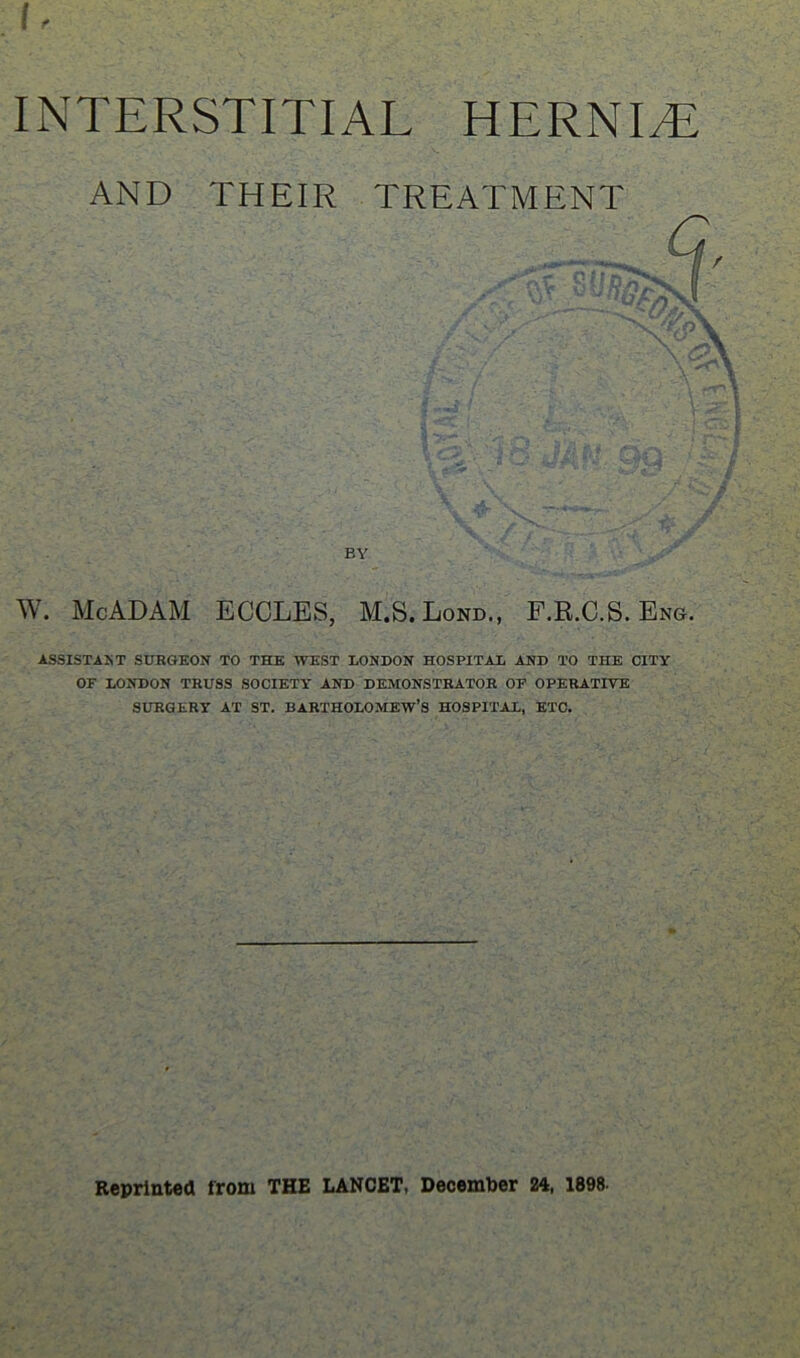 h INTERSTITIAL HERNI.E AND THEIR TREATMENT W. McADAM ECOLES, M.S.Lond., P.B.C.S. Ese. ASSISTANT SURGEON TO THE WEST LONDON HOSPITAL AND TO THE CITY OF LONDON TRUSS SOCIETY AND DEMONSTRATOR OF OPERATIVE SURGERY AT ST. BARTHOLOMEW’S HOSPITAL, ETC.