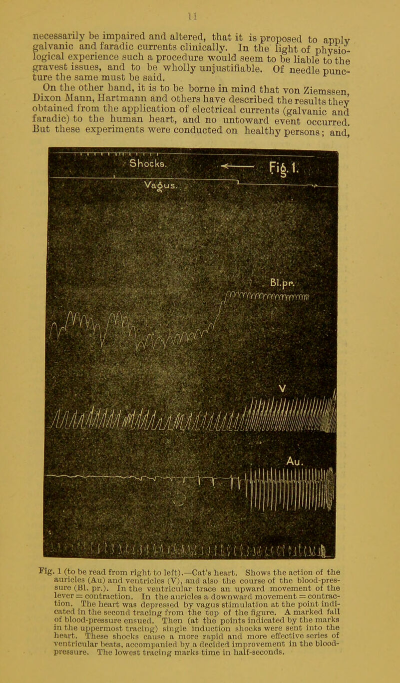 necessarily be impaired and altered, that it is proposed to apply galvanic and faradic currents clinically. In the light of physio- logical experience such a procedure would seem to be liable to the gravest issues, and to be wholly unjustifiable. Of needle punc- ture the same must be said. On the other hand, it is to be borne in mind that yon Ziemssen Dixon Mann, Hartmann and others have described the results they obtained from the application of electrical currents (galvanic and faradic) to the human heart, and no untoward event occurred. But these experiments were conducted on healthy persons; audi Fig. 1 (to be read from right to left).—Cat's heart. Shows the action of the auricles (Au) and ventricles (V), and also the course of the blood-pres- sure (Bl. pr.). In the ventricular trace an upward movement of the lever = contraction. In the auricles a downward movement = contrac- tion. The heart was depressed by vagus stimulation at the point indi- cated in the second tracing from the top of the figure. A marked fall of blood-pressure ensued. Then (at the points indicated by the marks in the uppermost tracing) single induction shocks were sent into the heftrt. These shocks cause a more rapid and more effective series of ventricular beats, accompanied by a decided improvement in the blood- pressure. The lowest tracing marks time in half-seconds.