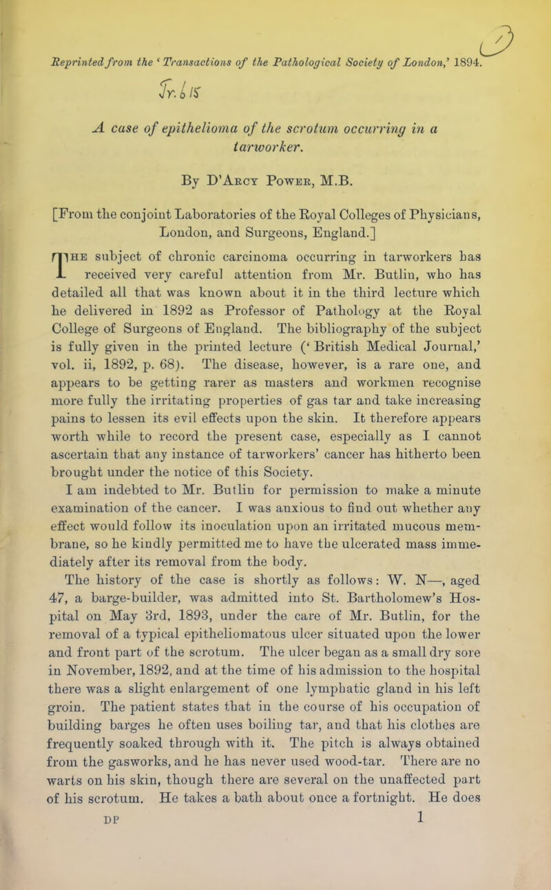 Reprinted from the 'Transactions of the Pathological Society of London' 1894. fr.llS A case of epithelioma of the scrotum occurring in a iarworker. By D'Aect Power, M.B. [From the conjoint Laboratories of the Royal Colleges of Physicians, London, and Surgeons, England.] mHE subject of chronic carcinoma occurring in tarworkers has L received very careful attention from Mr. Butlin, who has detailed all that was known about it in the third lecture which he delivered in 1892 as Professor of Pathology at the Royal College of Surgeons of England. The bibliography of the subject is fully given in the printed lecture (' British Medical Journal,' vol. ii, 1892, p. 68). The disease, however, is a rare one, and appears to be getting rarer as masters and workmen recognise more fully the irritating properties of gas tar and take increasing pains to lessen its evil effects upon the skin. It therefore appears worth while to record the present case, especially as I cannot ascertain that any instance of tarworkers' cancer has hitherto been brought under the notice of this Society. I am indebted to Mr. Butlin for permission to make a minute examination of the cancer. I was anxious to find out whether any effect would follow its inoculation upon an irritated mucous mem- brane, so he kindly permitted me to have the ulcerated mass imme- diately after its removal from the body. The history of the case is shortly as follows: W. N—, aged 47, a barge-builder, was admitted into St. Bartholomew's Hos- pital on May 3rd, 1893, under the care of Mr. Butlin, for the removal of a typical epitheliomatous ulcer situated upon the lower and front part of the scrotum. The ulcer began as a small dry sore in November, 1892, and at the time of his admission to the hospital there was a slight enlargement of one lymphatic gland in his left groin. The patient states that in the course of bis occupation of building barges be often uses boiling tar, and that bis clothes are frequently soaked through with it. The pitch is always obtained from the gasworks, and he has never used wood-tar. There are no warts on his skin, though there are several on the unaffected part of his scrotum. He takes a bath about once a fortnight. He does