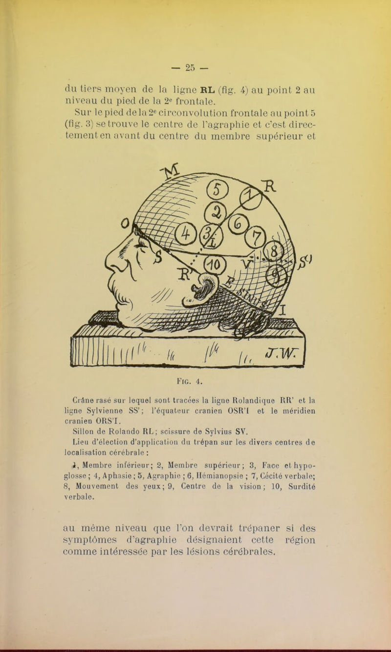 du tiers moyen de la ligne RL (fig. 4) au point 2 au niveau du pied de la 2e frontale. Sur le pied de la 2e circonvolution frontale au point 5 (flg. 3) se trouve le centre de Tagraphie et c'est direc- tement en avant du centre du membre supérieur et FlG. 4. Crâne rasé sur lequel sont tracées la ligne Rolandique RR' et la ligne Sylvienne SS'; l'équateur crânien OSR'I et le méridien crânien ORS'I. Sillon de Rolando RL; scissure de Sylvius SV. Lieu d'élection d'application du trépan sur les divers centres de localisation cérébrale : 1, Membre inférieur; 2, Membre supérieur; 3, Face et hypo- glosse ; 4, Aphasie ; 5, Agraphie ; 6, Hémianopsie ; 7, Cécité verbale; 8, Mouvement des yeux; 9, Centre de la vision; 10, Surdité verbale. au même niveau que Ton devrait trépaner si des S} mptômes d'agraphie désignaient cette région comme intéressée par les lésions cérébrales.