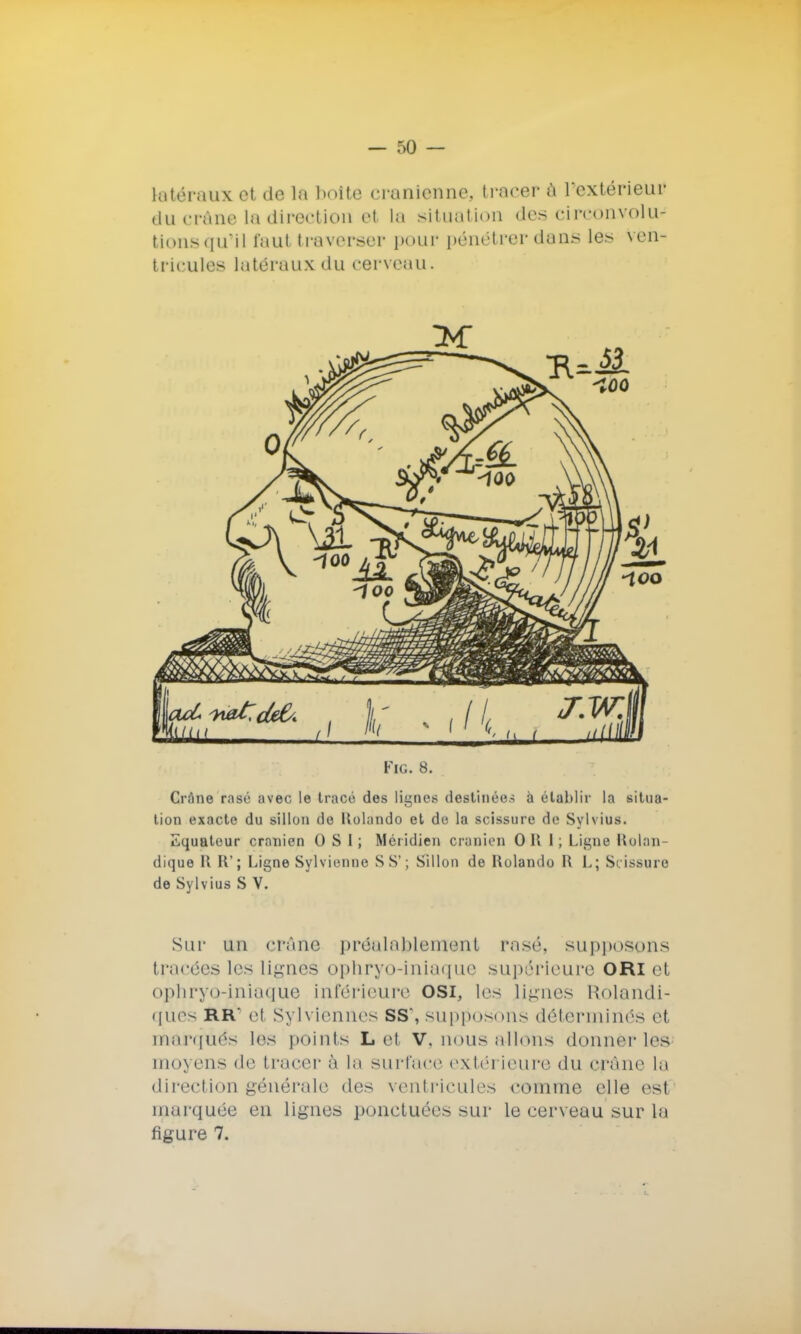 latéraux et de la boite crânienne, tracer à l'extérieur du crâne la direction et ta situation des circonvolu- tionsqu'il faut traverser pour pénétrer dans les ven- tricules latéraux du cerveau. Fie. 8. Crâne rasé avec le tracé des lignes destinées à établir la situa- tion exacte du sillon de Kolando et de la scissure de Sylvius. Equateur crânien 0 S I ; Méridien crânien 0 H I ; Ligne Holan- dique R R'; Ligne Syl vienne SS'; Sillon de Holando R L; Scissure de Sylvius S V. Sur un crâne préalablement rasé, supposons t l acées les lignes ophryo-iniaque supérieure ORi et ophryo-iniaque inférieure OSi, les lignes Rolandi- ques RR' et Sylviennes ss', supposons déterminés e1 marqués les points L et V. nous niions donner les moyens de tracer è la surface extérieure du crâne la direction générale des ventricules comme elle est inarquée en lignes ponctuées sur le cerveau sur la figure 7.