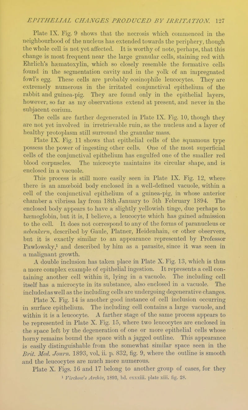Plate IX. Fig. 9 shows that the necrosis which commenced in the neighbourhood of the nucleus has extended towards the periphery, though the whole cell is not yet affected. It is worthy of note, perhaps, that this change is most frequent near the large granular cells, staining red with Ehrlich's hematoxylin, which so closely resemble the formative cells found in the segmentation cavity and in the yolk of an impregnated fowl's egg. These cells are probably eosinophile leucocytes. They are extremely numerous in the irritated conjunctival epithelium of the rabbit and guinea-pig. They are found only in the epithelial layers, however, so far as my observations extend at present, and never in the subjacent corium. The cells are farther degenerated in Plate IX. Fig. 10, though they arc not yet involved in irretrievable ruin, as the nucleus and a layer of healthy protoplasm still surround the granular mass. Plate IX. Fig. 11 shows that epithelial cells of the squamous type possess the power of ingesting other cells. One of the most superficial cells of the conjunctival epithelium has engulfed one of the smaller red blood corpuscles. The microcyte maintains its circular shape, and is enclosed in a vacuole. This process is still more easily seen in Plate IX. Fig. 12, where there is an amoeboid body enclosed in a well-defined vacuole, within a cell of the conjunctival epithelium of a guinea-pig, in whose anterior chamber a vibrissa lay from 18th January to 5th February 1894. The enclosed body appears to have a slightly yellowish tinge, due perhaps to haemoglobin, but it is, I believe, a leucocyte which has gained admission to the cell. It does not correspond to any of the forms of paranucleus or ncbcnkern, described by Gaule, Platner, Heidenhain, or other observers, but it is exactly similar to an appearance represented by Professor Pawlowsky,1 and described by him as a parasite, since it was seen in a malignant growth. A double inclusion has taken place in Plate X. Fig. 13, which is thus a more complex example of epithelial ingestion. It represents a cell con- taining another cell within it, lying in a vacuole. The including cell itself has a microcyte in its substance, also enclosed in a vacuole. The included as well as the including cells are undergoing degenerative changes. Plate X. Fig. 14 is another good instance of cell inclusion occurring in surface epithelium. The including cell contains a large vacuole, and within it is a leucocyte. A farther stage of the same process appears to be represented in Plate X. Fig. 15, where two leucocytes are enclosed in the space left by the degeneration of one or more epithelial cells whose horny remains bound the space with a jagged outline. This appearance is easily distinguishable from the somewhat similar space seen in the Brit. Med. Journ, 1893, vol, ii. p. 832, fig. 9, where the outline is smooth and the leucocytes are much more numerous. Plate X. Figs. 16 and 17 belong to another group of cases, for they 1 Virchoic's Archiv, 1893, bd. exxxiii. plate xiii. fig. 23.