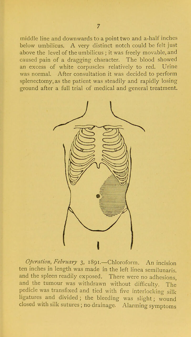 middle line and downwards to a point two and a-half inches below umbilicus. A very distinct notch could be felt just above the level of the umbilicus ; it was freely movable, and caused pain of a dragging character. The blood showed an excess of white corpuscles relatively to red. Urine was normal. After consultation it was decided to perform splenectomy, as the patient was steadily and rapidly losing ground after a full trial of medical and general treatment. Operation, February 3, 1891.—Chloroform. An incision ten inches in length was made in the left linea semilunaris, and the spleen readily exposed. There were no adhesions, and the tumour was withdrawn without difficulty. The pedicle was transfixed and tied with five interlocking silk ligatures and divided ; the bleeding was slight; wound closed with silk sutures ; no drainage. Alarming symptoms