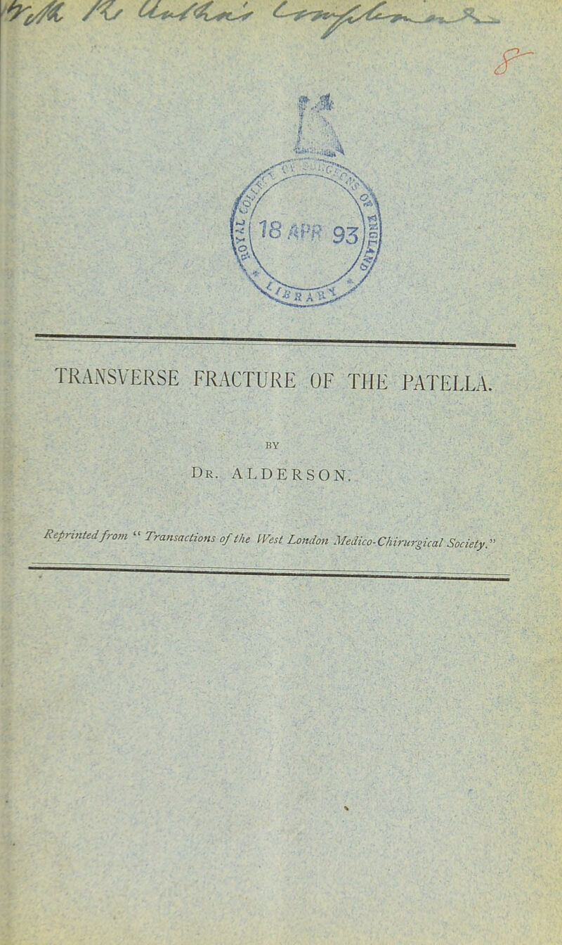 TRANSVERSE FRACTURE OF THE PATELLA. BY Dr. ALDERS ON. Reprinted from « Transactions of the West London Medico-Chirurgical Society.