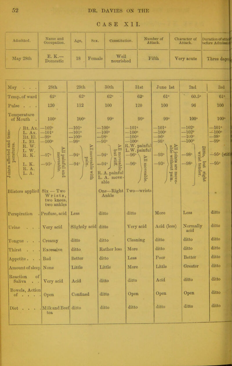 CASE XII. Admitted. Name and Occupation. Age. Sex. Constitution. Number of Attack. Character of Attack. Duration of atta licfore Admiadi May 28th E. K.— Domestic 18 Female Well nourished Fifth Very acute Three days May . . . 28th 29th 30th 31st June 1st 2nd 3rd Temp, of ward 62° 62° 62° 62° 61 0 ' 60.5° 61° Pulse . . . 120 112 100 120 100 96 100 Temperature of Mouth . 100° 100° 99° 99° 99° 100° 100° / Rt. Ax. | f L. Ax. -2 Rt. El. <g . L. El. S g R. W. 11 L. W. R. K. d L K. 3 R. A. 'rB T, A * \ —102° —101° —99° —100° ■hi* -••lit —95° ) 1 5> CP 91 J I —101° —101° —100° —98° X | —940 « i p s —94° ) 5' | 1 J / 1 —100° —100° —98° —98° -94° \5g /il —94° 1 pig. ^ a R. A. painful L. A. move- able —101° —100° —100° —100° R.W. painful L. W. painful -96-w —96° h )i if —101° —100° —9(!° —98° \ —93° —93° ) All joints are move- able without pain. —102° —102° —1110° —100° —98° —98° Ditto, but right wist tender. —101° —100° —98° —v\f° —96° Blisters applied Six — Two Wrists, two knees, two ankles One—Right Ankle Two—wrist.s Perspiration Profuse, acid Less ditto ditto More Less ditto Urine . . . Very acid Slightly acid ditto Very acid Acid (Icsr) Normally acid ditto Tongue . . . Creamy ditto ditto Cleaning ditto ditto ditto Thirst . . . Excessive ditto Rather less More ditto ditto ditto Appetite. . . Bad Better ditto Less Poor Better ditto Amount of sleer None Little Little More Little Greater ditto Reaction of Saliva . . Very acid Acid ditto ditto Acid ditto ditto Bowels, Actior of . . . i Open Confined ditto Open Open Open ditto tea