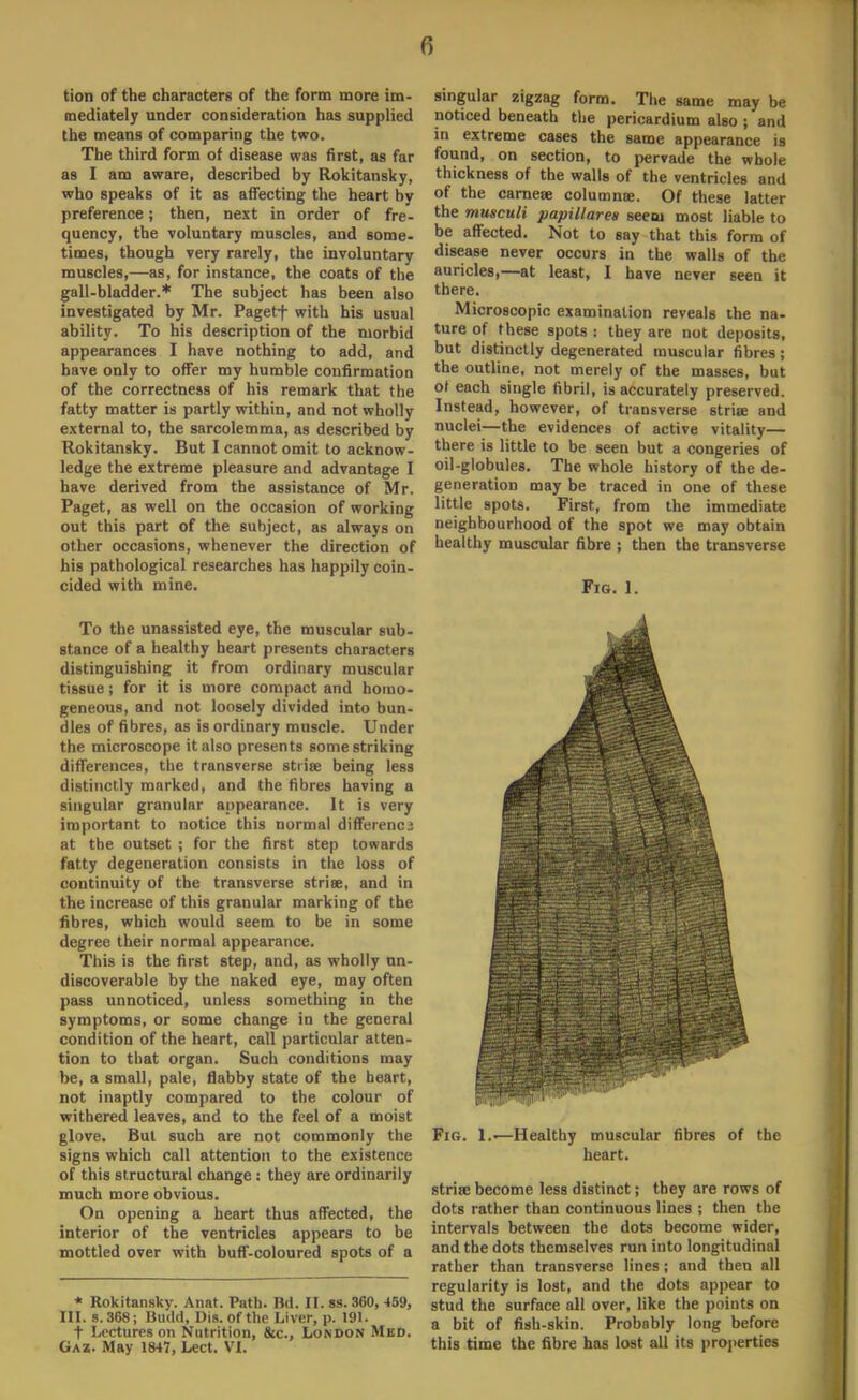 tion of the characters of the form more im- mediately under consideration has supplied the means of comparing the two. The third form of disease was first, as far as I am aware, described by Rokitansky, who speaks of it as affecting the heart by preference; then, next in order of fre- quency, the voluntary muscles, and some- times, though very rarely, the involuntary muscles,—as, for instance, the coats of the gall-bladder.* The subject has been also investigated by Mr. Pagetf with his usual ability. To his description of the morbid appearances I have nothing to add, and have only to offer my humble confirmation of the correctness of his remark that the fatty matter is partly within, and not wholly external to, the sarcolemma, as described by Rokitansky. But I cannot omit to acknow- ledge the extreme pleasure and advantage I have derived from the assistance of Mr. Paget, as well on the occasion of working out this part of the subject, as always on other occasions, whenever the direction of his pathological researches has happily coin- cided with mine. To the unassisted eye, the muscular sub- stance of a healthy heart presents characters distinguishing it from ordinary muscular tissue; for it is more compact and homo- geneous, and not loosely divided into bun- dles of fibres, as is ordinary muscle. Under the microscope it also presents some striking differences, the transverse striae being less distinctly marked, and the fibres having a singular granular appearance. It is very important to notice this normal differenc3 at the outset ; for the first step towards fatty degeneration consists in the loss of continuity of the transverse striee, and in the increase of this granular marking of the fibres, which would seem to be in some degree their normal appearance. This is the first step, and, as wholly un- discoverable by the naked eye, may often pass unnoticed, unless something in the symptoms, or some change in the general condition of the heart, call particular atten- tion to that organ. Such conditions may be, a small, pale, flabby state of the heart, not inaptly compared to the colour of withered leaves, and to the feel of a moist glove. But such are not commonly the signs which call attention to the existence of this structural change : they are ordinarily much more obvious. On opening a heart thus affected, the interior of the ventricles appears to be mottled over with buff-coloured spots of a * Rokitansky. Anat. Path. Bd. II. ss. 360, 459, III. s. 368; Budd, Dis. of the Liver, p. 191. t Lectures on Nutrition, &c, London Mkd. Gaz. May 1847, Lect. VI. singular zigzag form. The same may be noticed beneath the pericardium also j and in extreme cases the same appearance is found, on section, to pervade the whole thickness of the walls of the ventricles and of the carnese columnse. Of these latter the musculi papillares seem most liable to be affected. Not to say that this form of disease never occurs in the walls of the auricles,—at least, I have never seen it there. Microscopic examination reveals the na- ture of these spots : they are not deposits, but distinctly degenerated muscular fibres; the outline, not merely of the masses, but of each single fibril, is accurately preserved. Instead, however, of transverse strise and nuclei—the evidences of active vitality— there is little to be seen but a congeries of oil-globules. The whole history of the de- generation may be traced in one of these little spots. First, from the immediate neighbourhood of the spot we may obtain healthy muscular fibre ; then the transverse Fig. 1. Fir. 1.^Healthy muscular fibres of the heart. stria? become less distinct; tbey are rows of dots rather than continuous lines ; then the intervals between the dots become wider, and the dots themselves run into longitudinal rather than transverse lines; and then all regularity is lost, and the dots appear to stud the surface all over, like the points on a bit of fish-skin. Probably long before this time the fibre has lost all its properties