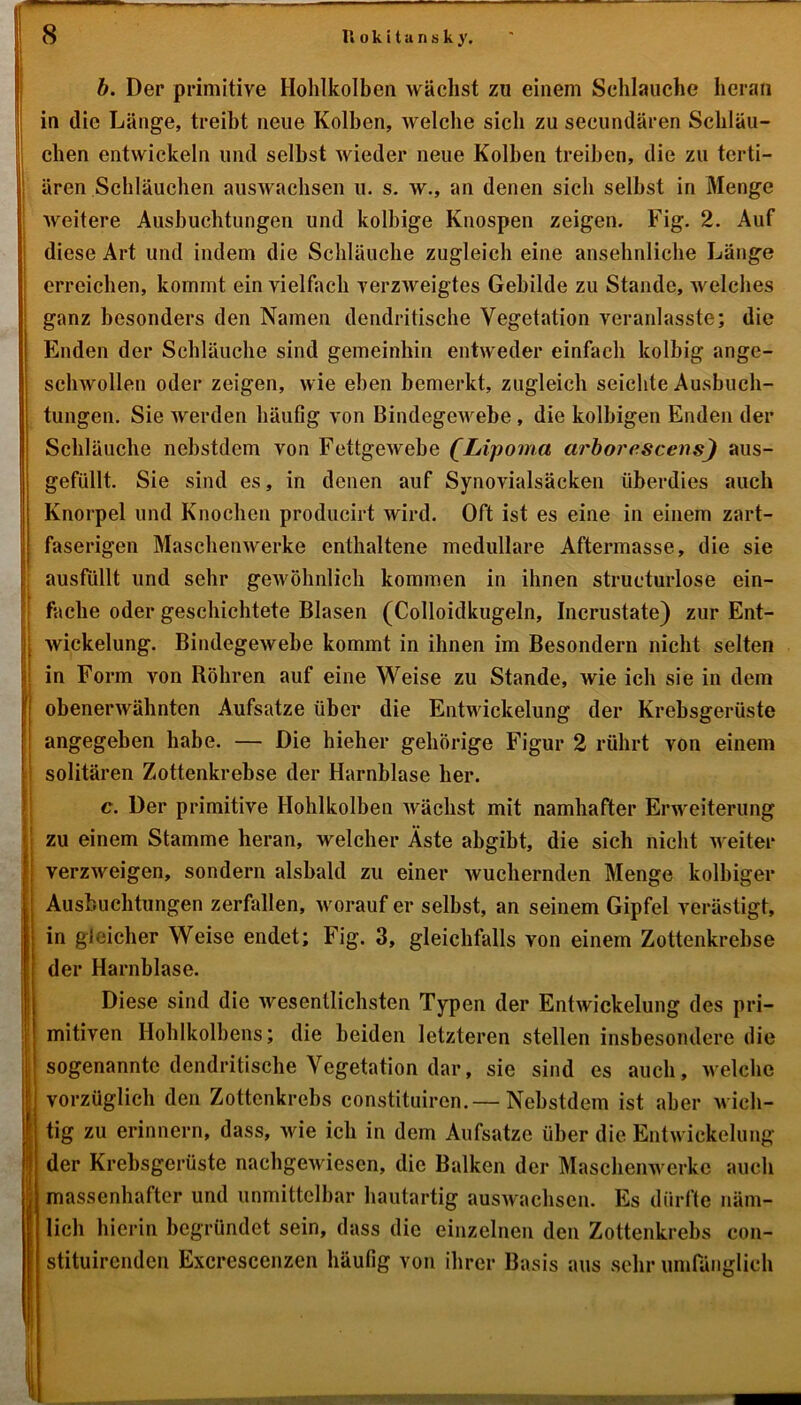 b. Der primitive Hohlkolben wächst zu einem Schlauche heran in die Länge, treibt neue Kolben, welche sich zu secundären Schläu- chen entwickeln und selbst wieder neue Kolben treiben, die zu terti- ären Schläuchen auswachsen u. s. w., an denen sich selbst in Menge weitere Ausbuchtungen und kolbige Knospen zeigen. Fig. 2. Auf diese Art und indem die Schläuche zugleich eine ansehnliche Länge erreichen, kommt ein vielfach verzweigtes Gebilde zu Stande, welches ganz besonders den Namen dendritische Vegetation veranlasste; die Enden der Schläuche sind gemeinhin entweder einfach kolbig ange- schwollen oder zeigen, wie eben bemerkt, zugleich seichte Ausbuch- tungen. Sie werden häufig von Bindegewebe , die kolbigen Enden der Schläuche nebstdem von Fettgewebe (Lipoma arborescens) aus- gefüllt. Sie sind es, in denen auf Synovialsäcken überdies auch Knorpel und Knochen producirt wird. Oft ist es eine in einem zart- faserigen Maschenwerke enthaltene medulläre Aftermasse, die sie ausfüllt und sehr gewöhnlich kommen in ihnen structurlose ein- fache oder geschichtete Blasen (Colloidkugeln, Incrustate) zur Ent- wickelung. Bindegewebe kommt in ihnen im Besondern nicht selten in Form von Röhren auf eine Weise zu Stande, wie ich sie in dem obenerwähnten Aufsätze über die Entwickelung der Krebsgerüste angegeben habe. — Die Melier gehörige Figur 2 rührt von einem solitären Zottenkrebse der Harnblase her. c. Der primitive Hohlkolben wächst mit namhafter Erweiterung zu einem Stamme heran, welcher Äste abgibt, die sich nicht weiter verzweigen, sondern alsbald zu einer wuchernden Menge kolbiger Ausbuchtungen zerfallen, worauf er selbst, an seinem Gipfel verästigt, in gleicher Weise endet; Fig. 3, gleichfalls von einem Zottenkrebse der Harnblase. Diese sind die wesentlichsten Typen der Entwickelung des pri- mitiven Hohlkolbens; die beiden letzteren stellen insbesondere die sogenannte dendritische Vegetation dar, sie sind es auch, welche vorzüglich den Zottenkrebs constituiren.— Nebstdem ist aber wich- tig zu erinnern, dass, wie ich in dem Aufsatze über die Entwickelung Ider Krebsgerüste nachgewiesen, die Balken der Maschenwerke auch massenhafter und unmittelbar hautartig auswachsen. Es dürfte näm- lich hierin begründet sein, dass die einzelnen den Zottenkrebs con- stituirenden Excrescenzen häufig von ihrer Basis aus sehr umfänglich