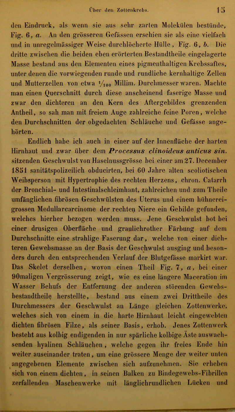 (len Eindruck, als wenn sie aus sehr zarten Molekülen bestünde, Fig. 6, a. An den grösseren Gelassen erschien sie als eine vielfach und in unregelmässiger Weise durchlöcherte Hülle, Fig. 6, b. Die dritte zwischen die beiden eben erörterten Bestandtheile eingelagerte Masse bestand aus den Elementen eines pigmenthaltigen Krebssaftes, unter denen die vorwiegenden runde und rundliche kernhaltige Zellen und Mutterzellen von etwa yi00 Millim. Durchmesser waren. Machte man einen Querschnitt durch diese anscheinend faserige Masse und zwar den dichteren an den Kern des Aftergebildes grenzenden Antheil, so sah man mit freiem Auge zahlreiche feine Poren, welche den Durchschnitten der obgedachten Schläuche und Gefässe ange- hörten. Endlich habe ich auch in einer auf der Innenfläche der harten Hirnhaut und zwar über dem Processus clinoideus anticus sin. sitzenden Geschwulst von Haselnussgrösse bei einer am 27. December 1851 sanitätspolizeilich obducirten, bei 60 Jahre alten scoliotisclien Weibsperson mit Hypertrophie des rechten Herzens, cliron. Catarrh der Bronchial- und Intestinalschleimhant, zahlreichen und zum Theile umfänglichen fibrösen Geschwülsten des Uterus und einem hühnerei- grossen Medullarcarcinome der rechten Niere ein Gebilde gefunden, welches hierher bezogen werden muss. Jene Geschwulst bot bei einer drüsigen Oberfläche und graulichrother Färbung auf dem Durchschnitte eine strahlige Faserung dar, welche von einer dich- teren Gewebsmasse an der Basis der Geschwulst ausging und beson- ders durch den entsprechenden Verlauf der Blutgefässe markirt war. Das Skelet derselben, wovon einen Thcil Fig. 7, a, bei einer 90maligen Vergrösserung zeigt, wie es eine längere Maceration im Wasser Behufs der Entfernung der anderen störenden Gewebs- bestandtheile herstellte, bestand aus einem zwei Drittheile des Durchmessers der Geschwulst an Länge gleichen Zottenwerke, welches sich von einem in die harte Hirnhaut leicht eingewebten dichten fibrösen Filze, als seiner Basis, erhob. Jenes Zottenwerk besteht aus kolbig endigenden in nur spärliche kolbige Äste auswach- senden hyalinen Schläuchen , welche gegen ihr freies Ende hin weiter auseinander traten, um eine grössere Menge der weiter unten angegebenen Elemente zwischen sich aufzunehmen. Sie erheben sich von einem dichten, in seinen Balken zu Bindegewebs-Fibrillen zerfallenden Maschenwerke mit länglichrundlichen Lücken und