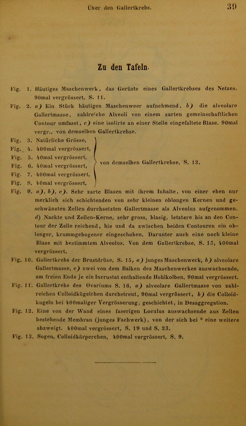 Zu den Tafeln. Fig. 1. Häutiges Maschenwerk, das Gerüste eines Gallertkrebses des Netzes. 90mal vergrössert, S. 11. Fig. 2. a) Ein Stück häutigen Maschenweer aufnehmend, b) die alveolare Gallertmasse, zahlre!che Alveoli von einem zarten gemeinschaftlichen Contour umfasst , c) eine isolirte an einer Stelle eingefaltete Blase. 90mal vergr., von demselben Gallertkrebse. Fig. 3. Natürliche Grösse, Fig. 4. 400mal vergrössert, Fig. 5. 40mal vergrössert, Fig. 6. 40mal vergrössert, Fig. 7. 400mal vergrössert, Fig. 8. 40mal vergrössert, Fig. 9. u), b), c). Sehr zarte Blasen mit ihrem Inhalte, von einer eben nur merklich sich schichtenden von sehr kleinen oblongen Kernen und ge- schwänzten Zellen durchsetzten Gallertmasse als Alveolus aufgenommen. d) Nackte und Zellen-Kerne, sehr gross, blasig, letztere bis an den Con- tour der Zelle reichend, hie und da zwischen beiden Contouren ein ob- longer, krummgebogener eingeschoben. Darunter auch eine noch kleine Blase mit bestimmtem Alveolus. Von dem Gallertkrebse, S. 13, 400mal vergrössert. Fig. 10. Gallertkrebs der Brustdrüse, S. 15, a) junges Maschenwerk, b) alveolare Gallertmasse, c) zwei von dem Balken des Maschenwerkes auswachsende, am freien Ende je ein Incrustat enthaltende Hohlkolben. 90mal vergrössert. Fig. 11. Gallertkrebs des Ovariums S. 16, a) alveolare Gallertmasse von zahl- reichen Colloidkiigelchen durchstreut, 90mal vergrössert, b) die Colloid- kugeln bei 400maliger Vergrösserung, geschichtet, in Desaggregation. Fig. 12. Eine von der Wand eines faserigen Loculus auswachsende aus Zellen bestehende Membran (junges Fachwerk), von der sich bei * eine weitere abzweigt. 400mal vergrössert, S. 19 und S. 23. von demselben Gallertkrebse, S. 12.