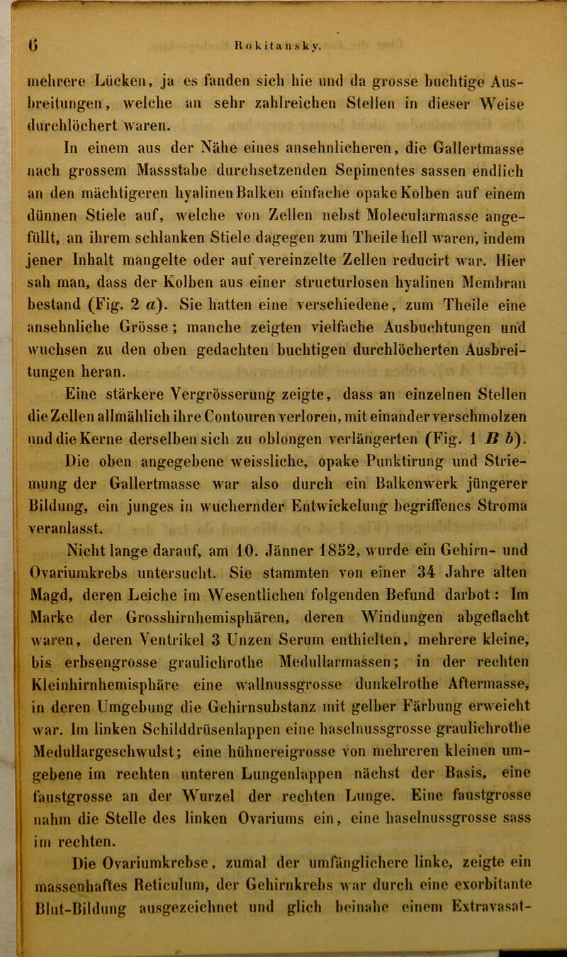 mehrere Lücken, ja es fanden sicli hie und da grosse buchtige Aus- breitungen , welche an sehr zahlreichen Stellen in dieser Weise durchlöchert waren. In einem aus der Nähe eines ansehnlicheren, die Gallertmasse nach grossem Massstabe durchsetzenden Sepimentes sassen endlich an den mächtigeren hyalinen Balken einfache opake Kolben auf einem dünnen Stiele auf, welche von Zellen nebst Molecularmasse ange- füllt, an ihrem schlanken Stiele dagegen zum Theilehell waren, indem jener Inhalt mangelte oder auf vereinzelte Zellen reducirt A\ar. Hier sah man, dass der Kolben aus einer structurlosen hyalinen Membran bestand (Fig. 2 d). Sie hatten eine verschiedene, zum Theile eine ansehnliche Grösse; manche zeigten vielfache Ausbuchtungen und wuchsen zu den oben gedachten buchtigen durchlöcherten Ausbrei- tungen heran. Eine stärkere Vergrösserung zeigte, dass an einzelnen Stellen die Zellen allmählich ihre Contouren verloren, mit einander verschmolzen und die Kerne derselben sich zu oblongen verlängerten (Fig. 1 B b'). Die oben angegebene Aveissliche, opake Punktirung und Strie- mung der Gallertmasse war also durch ein BalkenAverk jüngerer Bildung, ein junges in wuchernder Entwickelung begriffenes Stroma veranlasst. Nicht lange darauf, am 10. Jänner 1852, wurde ein Gehirn- und Ovariumkrebs untersucht. Sie stammten von einer 34 Jahre alten Magd, deren Leiche im Wesentlichen folgenden Befund darbot: Im Marke der Grosshirnhemisphären, deren Windungen abgeflacht waren, deren Ventrikel 3 Unzen Serum enthielten, mehrere kleine, bis erbsengrosse grauliehrothe Medullarmassen; in der rechten Kleinhirnhemisphäre eine wallnussgrosse dunkelrothe Aftermasse, in deren Umgebung die Gehirnsubstanz mit gelber Färbung erweicht war. Im linken Schilddrüsenlappen eine haselnussgrosse grauliehrothe MedullargescliAvulst; eine hühnereigrosse von mehreren kleinen um- i gebene im rechten unteren Lungenlappen nächst der Basis, eine faustgrosse an der Wurzel der rechten Lunge. Eine faustgrosse nahm die Stelle des linken Ovariums ein, eine haselnussgrosse sass im rechten. Die Ovariumkrebse, zumal der umfänglichere linke, zeigte ein massenhaftes Reticulum, der Gehirnkrebs Aval* durch eine exorbitante Blut-Bildung ausgezeichnet und glich beinahe einem Extravasat-