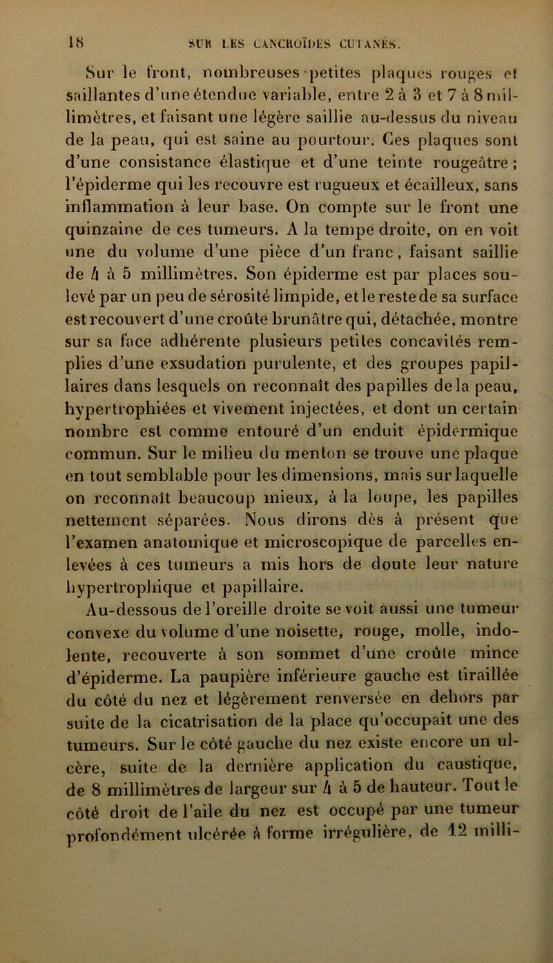 Sur le front, nombreuses petites plaques rouges et saillantes d’une étendue variable, entre 2 à 3 et 7 à 8 mil- limètres, et faisant une légère saillie au-dessus du niveau de la peau, qui est saine au pourtour. Ces plaques sont d’une consistance élastique et d’une teinte rougeâtre ; l’épiderme qui les recouvre est rugueux et écailleux, sans inflammation à leur base. On compte sur le front une quinzaine de ces tumeurs. A la tempe droite, on en voit une du volume d’une pièce d’un franc, faisant saillie de h à 5 millimètres. Son épiderme est par places sou- levé par un peu de sérosité limpide, et le reste de sa surface est recouvert d’une croûte brunâtre qui, détachée, montre sur sa face adhérente plusieurs petites concavités rem- plies d’une exsudation purulente, et des groupes papil- laires dans lesquels on reconnaît des papilles delà peau, hypertrophiées et vivement injectées, et dont un certain nombre est comme entouré d’un enduit épidermique commun. Sur le milieu du menton se trouve une plaque en tout semblable pour les dimensions, mais sur laquelle on reconnaît beaucoup mieux, à la loupe, les papilles nettement séparées. Nous dirons dès à présent que l’examen anatomique et microscopique de parcelles en- levées à ces tumeurs a mis hors de doute leur nature hypertrophique et papillaire. Au-dessous de l’oreille droite se voit aussi une tumeur convexe du volume d’une noisette, rouge, molle, indo- lente, recouverte à son sommet d’une croûte mince d’épiderme. La paupière inférieure gauche est tiraillée du côté du nez et légèrement renversée en dehors par suite de la cicatrisation de la place qu’occupait une des tumeurs. Sur le côté gauche du nez existe encore un ul- cère, suite de la dernière application du caustique, de 8 millimètres de largeur sur h à 5 de hauteur. Tout le côté droit de l’aile du nez est occupé par une tumeur profondément idcérée à forme irrégulière, de 12 inilh-