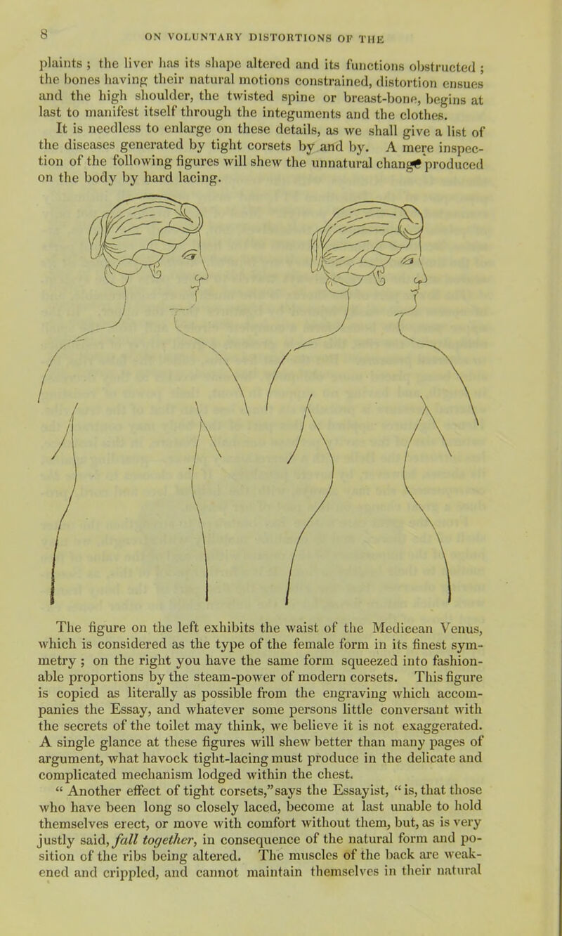 plaints ; the liver has its shape altered and its functions obstructed ; the bones havinfj; their natural motions constrained, distortion ensues and the high shoulder, the twisted spine or breast-bone, begins at last to manifest itself through the integuments and the clothes. It is needless to enlarge on these details, as we shall give a list of the diseases generated by tight corsets by and by. A mere inspec- tion of the following figures will shew the unnatural change produced on the body by hard lacing. The figure on the left exhibits the waist of the Medicean Venus, which is considered as the type of the female form in its finest sym- metry ; on the right you have the same form squeezed into fashion- able proportions by the steam-power of modern corsets. This figure is copied as literally as possible from the engraving which accom- panies the Essay, and whatever some persons little conversant with the secrets of the toilet may think, we believe it is not exaggerated. A single glance at these figures will shew better than many pages of argument, what havock tight-lacing must produce in the delicate and complicated mechanism lodged within the chest.  Another effect of tight corsets,says the Essayist, is, that those who have been long so closely laced, Ijecome at last unable to hold themselves erect, or move with comfort without them, but, as is very justly said, fall together, in consequence of the natural form and po- sition of the ribs being altered. The muscles of the back are weak- ened and crippled, and cannot maintain themselves in their natural