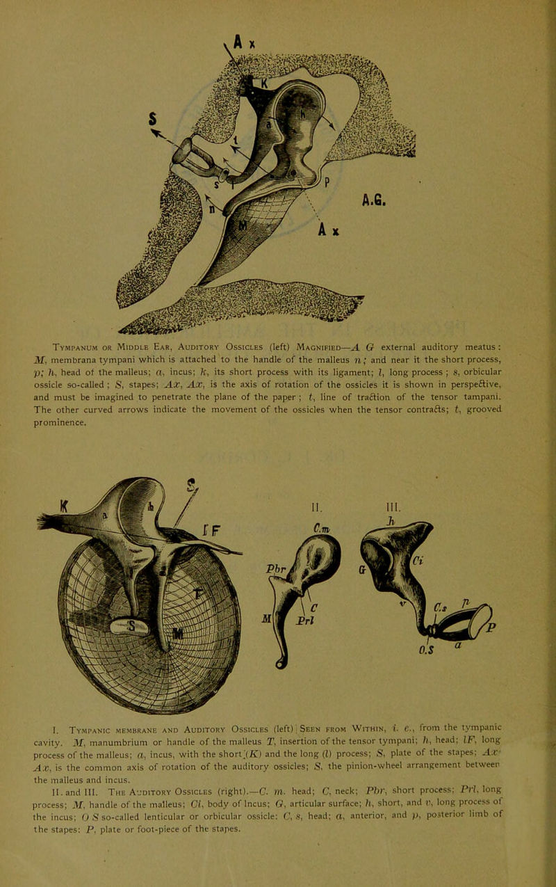 Tympanum or Middle Ear, Auditory Ossicles (left) Magnified—A G external auditory meatus: M, membrana tympani which is attached to the handle of the malleus 71; and near it the short process, p; /i, head of the malleus; n, incus; fc, its short process with its ligament; !, long process ; s, orbicular ossicle so-called ; S, stapes; AX., Ax, is the axis of rotation of the ossicles it is shown in perspeftive, and must be imagined to penetrate the plane of the paper ; t, line of traftion of the tensor tampani. The other curved arrows indicate the movement of the ossicles when the tensor contrafts; t, grooved prominence. I. Tympanic membrane and Auditory Ossicles (left), Seen from Within, i. c, from the tympanic cavity. M, manumbrium or handle of the malleus T, insertion of the tensor tympani; /), head: IF, long process of the malleus; a, incus, with the short ;(K) and the long (I) process; S, plate of the stapes; ^.i- Ax, is the common axis of rotation of the auditory ossicles; S, the pinion-wheel arrangement between the malleus and incus. II. and III. The AvDiTORY Ossicles (right).—C. ml. head; C, neck; Phl\ short process; PH, long process; M. handle of the malleus; CU body of Incus; G, articular surface; /i, short, and r, long process of the incus; O S so-called lenticular or orbicular ossicle: (\ head: a. anterior, and posterior limb of the stapes: P, plate or foot-piece of the stapes.