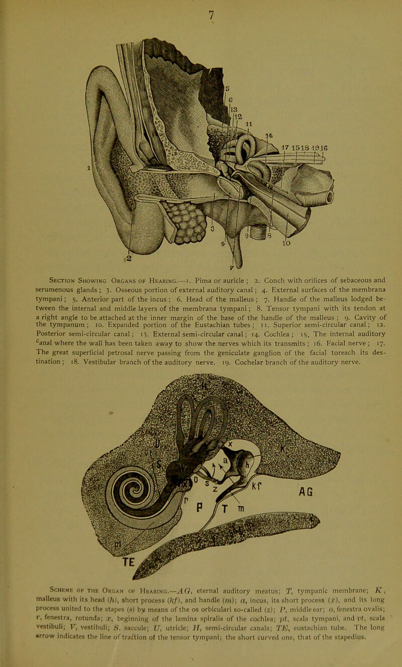 Section Showing Organs of Hearing.—i. Pima or auricle ; 2. Conch with orifices of sebaceous and serumenous glands ; 3. Osseous portion of external auditory canal; 4. External surfaces of the membrana tympani; 5. Anterior part of the incus; 6. Head of the malleus; 7. Handle of the malleus lodged be- tween the internal and middle layers of the membrana tympani; 8. Tensor tympani with its tendon at a right angle to be attached at the inner margin of the base of the handle of the malleus ; 9. Cavity of the tympanum; 10. Expanded portion of the Eustachian tubes; 11. Superior semi-circular canal; 12. Posterior semi-circular canal; 15. External semi-circular canal; 14. Cochlea; 15. The internal auditory ^anal where the wall has been taken away to show the nerves which its transmits ; 16. Facial nerve ; 17. The great superficial petrosal nerve passing from the geniculate ganglion of the facial toreach its des- tination ; 18. Vestibular branch of the auditory nerve. 19. Cochelar branch of the auditory nerve. Scheme op the Organ oi- Hearing.—AG, eternal auditory meatus; T, tympanic membrane; K, malleus with its head {h), short process (/c/), and handle (hi); n, incus, it.s short process (.!'), and its long process united to the stapes (x) by means of the os orbiculari so-called (z); I', middle ear; o, fenestra ovalis; fenestra, rotunda; x, beginning of the lamina spiralis of the cochlea; ))(, scala tympani, and r(, scala vestibuli; V, vestibuli; S, saccule; fj, utricle; II, semi-circular canals; eustachian tube. The long arrow indicates the line of traflion ol the tensor tympani; the short curved one, that of the stapedius.