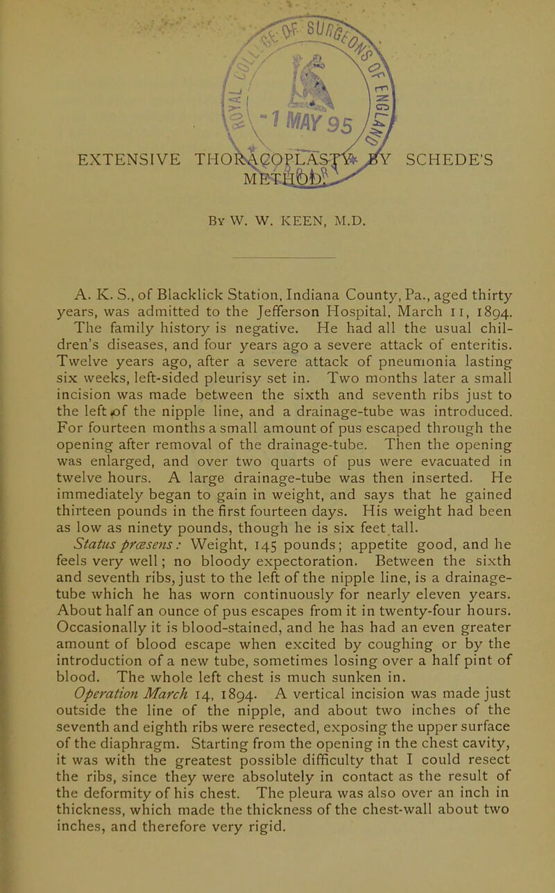 EXTENSIVE THORs^^OPLAS: ummM^ SCHEDE'S By VV. W. keen. M.D. A. K. S., of Blacklick Station. Indiana County, Pa., aged thirty years, was admitted to the Jefferson Hospital. March 11, 1894. The family history is negative. He had all the usual chil- dren's diseases, and four years ago a severe attack of enteritis. Twelve years ago, after a severe attack of pneumonia lasting six weeks, left-sided pleurisy set in. Two months later a small incision was made between the sixth and seventh ribs just to the left of the nipple line, and a drainage-tube was introduced. For fourteen months a small amount of pus escaped through the opening after removal of the drainage-tube. Then the opening was enlarged, and over two quarts of pus were evacuated in twelve hours. A large drainage-tube was then inserted. He immediately began to gain in weight, and says that he gained thirteen pounds in the first fourteen days. His weight had been as low as ninety pounds, though he is six feet tall. Status press ens: Weight. 145 pounds; appetite good, and he feels very well; no bloody expectoration. Between the sixth and seventh ribs, just to the left of the nipple line, is a drainage- tube which he has worn continuously for nearly eleven years. About half an ounce of pus escapes from it in twenty-four hours. Occasionally it is blood-stained, and he has had an even greater amount of blood escape when excited by coughing or by the introduction of a new tube, sometimes losing over a half pint of blood. The whole left chest is much sunken in. Operation March 14, 1894. A vertical incision was made just outside the line of the nipple, and about two inches of the seventh and eighth ribs were resected, exposing the upper surface of the diaphragm. Starting from the opening in the chest cavity, it was with the greatest possible difficulty that I could resect the ribs, since they were absolutely in contact as the result of the deformity of his chest. The pleura was also over an inch in thickness, which made the thickness of the chest-wall about two inches, and therefore very rigid.