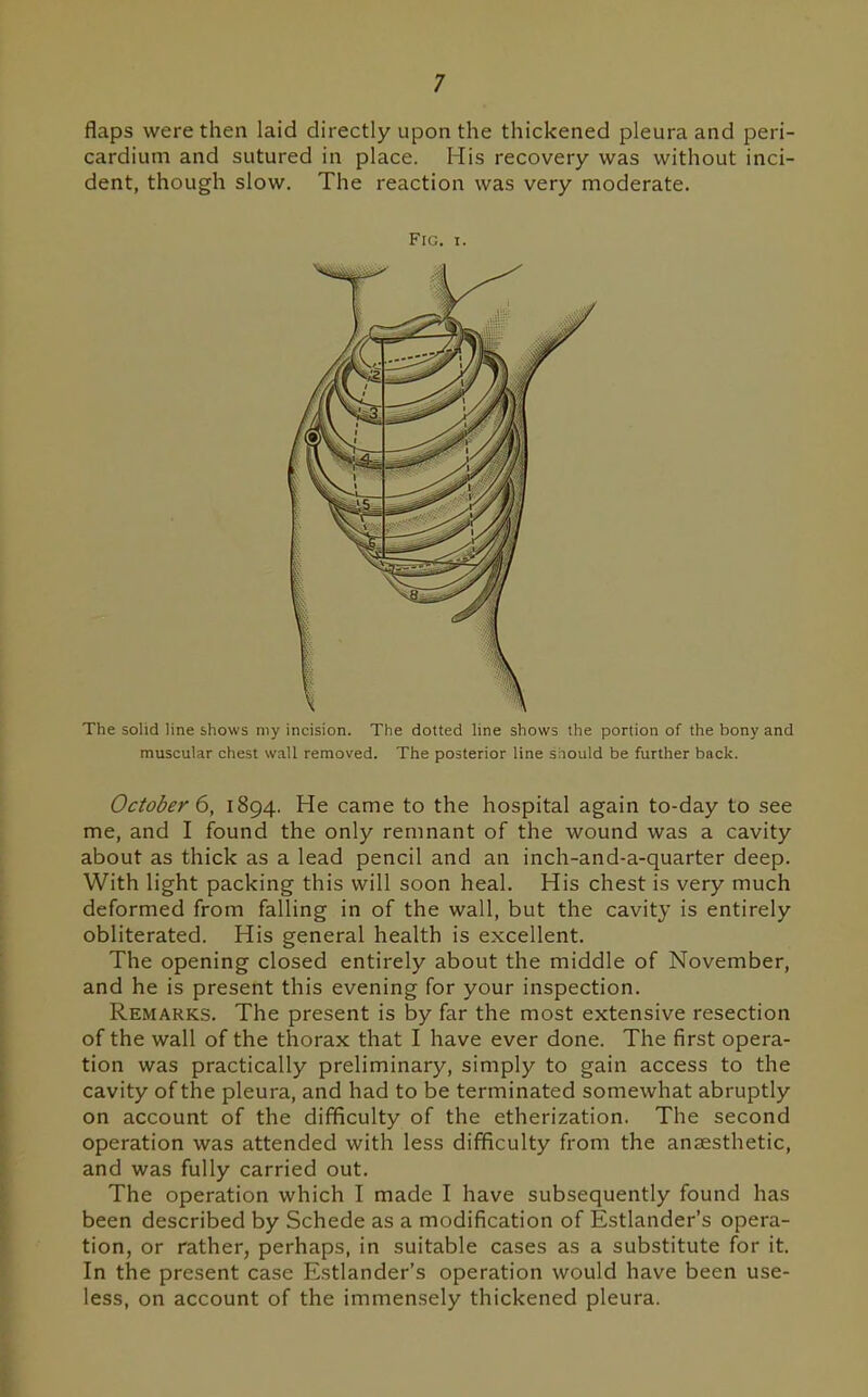 flaps were then laid directly upon the thickened pleura and peri- cardium and sutured in place. His recovery was without inci- dent, though slow. The reaction was very moderate. The solid line shows my incision. The dotted line shows the portion of the bony and muscular chest wall removed. The posterior line should be further back. October 6, 1894. He came to the hospital again to-day to see me, and I found the only remnant of the wound was a cavity about as thick as a lead pencil and an inch-and-a-quarter deep. With light packing this will soon heal. His chest is very much deformed from falling in of the wall, but the cavity is entirely obliterated. His general health is excellent. The opening closed entirely about the middle of November, and he is present this evening for your inspection. Remarks. The present is by far the most extensive resection of the wall of the thorax that I have ever done. The first opera- tion was practically preliminary, simply to gain access to the cavity of the pleura, and had to be terminated somewhat abruptly on account of the difficulty of the etherization. The second operation was attended with less difficulty from the anaesthetic, and was fully carried out. The operation which I made I have subsequently found has been described by Schede as a modification of Estlander's opera- tion, or rather, perhaps, in suitable cases as a substitute for it. In the present case Estlander's operation would have been use- less, on account of the immensely thickened pleura.