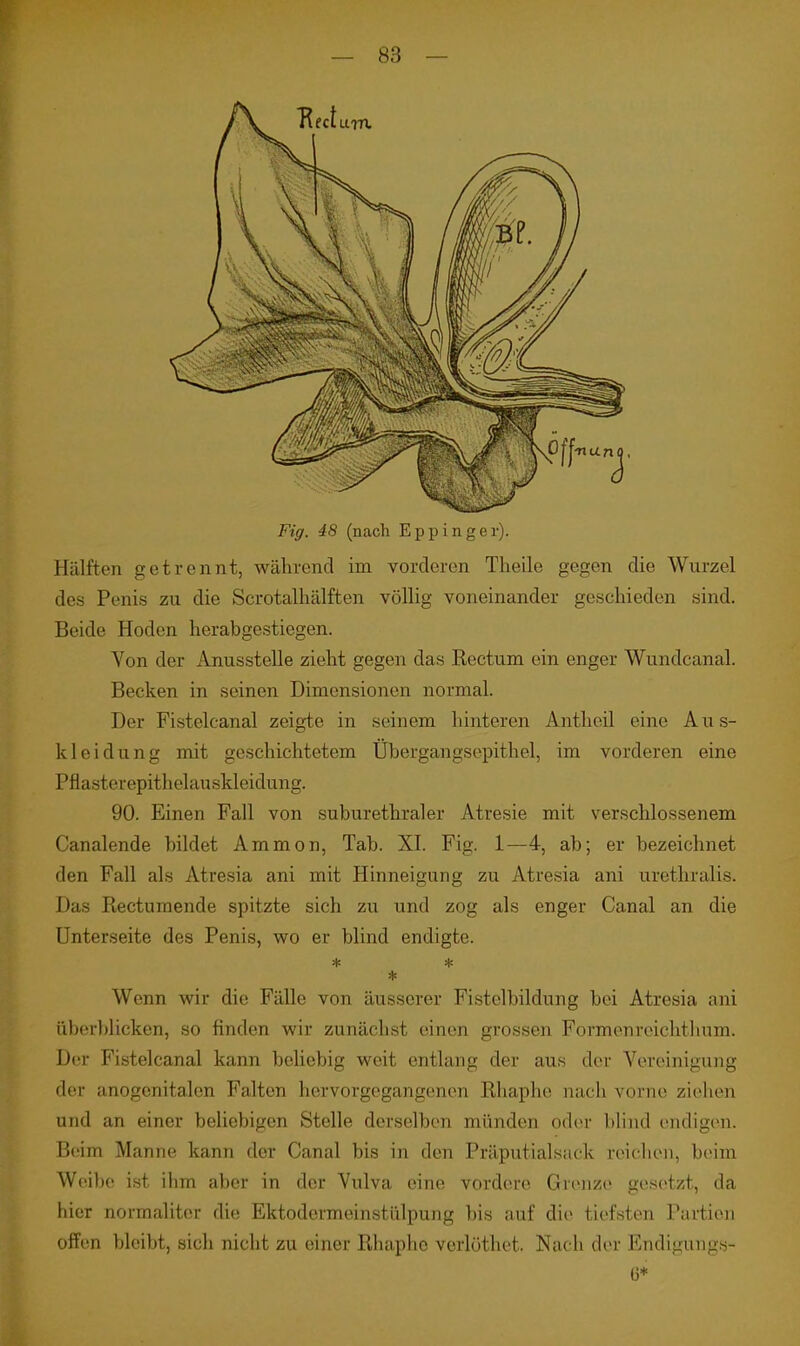 Fig. 48 (nach Eppiiiger). Hälften getrennt, während im vorderen Theile gegen die Wurzel des Penis zu die Scrotalhälften völlig voneinander geschieden sind. Beide Hoden herabgestiegen. Von der Anusstelle zieht gegen das Rectum ein enger Wundcanal. Becken in seinen Dimensionen normal. Der Fistelcanal zeigte in seinem hinteren Antheil eine Aus- kleidung mit geschichtetem Übergangsepithel, im vorderen eine Pflasterepithelauskleidung. 90. Einen Fall von suburethraler Atresie mit verschlossenem Canalende bildet Ammon, Tab. XI. Fig. 1—4, ab; er bezeichnet den Fall als Atresia ani mit Hinneigung zu Atresia ani urethralis. Das Piectumende spitzte sich zu und zog als enger Canal an die Unterseite des Penis, wo er blind endigte. * * * Wenn wir die Fälle von äusserer Fistclbildung bei Atresia ani überl)licken, so finden wir zunächst einen grossen Formenreiclithum. Der Fistelcanal kann beliebig weit entlang der aus der Voreinigung der anogenitalen Falten hervorgegangenen Rhaphe nach vorne ziehen und an einer beliebigen Stelle derselben münden oder blind endigen. Beim Manne kann der Canal bis in den Präputialsack reiclien, beim Weibe ist ihm aber in der Vulva eine vordere Grenze gesetzt, da hier normaliter die Ektodcrmeinstülpung bis auf die tiefsten Partien offen bleibt, sich nicht zu einer Rhaphe verlöthet. Nach der Endigungs-