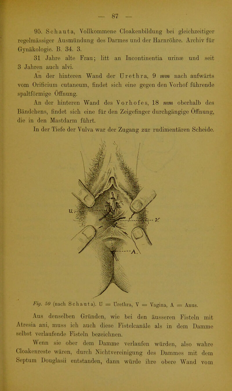 95. Schauta, Vollkommene Cloakenbildung bei gleichzeitiger regelmässiger Ausmüntlung des Darmes und der Harnröhre. Archiv für Gynäkologie. B. 34. 3. 31 Jahre alte Frau; litt an Incontinentia urinee und seit 3 Jahren auch alvi. An der hinteren Wand der Urethra, 9 mm nach aufwärts vom Orificium cutaneum, findet sich eine gegen den Vorhof führende spaltfürmige Öffnung. An der hinteren Wand des Vorhofes, 18 mm oberhalb des Bändchens, findet sich eine für den Zeigefinger durchgängige Öffnung, die in den Mastdarm führt. In der Tiefe der Vulva war der Zugang zur rudimentären Scheide. Fiff. 50 (nach Schauta). U = Urethra, V = Vagina, A = Anus. Aus denselben Gründen, wie bei den äusseren Fisteln mit Atresia ani, muss ich auch diese Fistelcanälc als in dem Damme selbst verlaufende Fisteln bezeichnen. Wenn sie ober dem Damme verlaufen würden, also wahre Cloakenreste wären, durch Nichtvereinigung des Dammes mit dem Öeptum Douglasii entstanden, dann würde ihre obere Wand vom