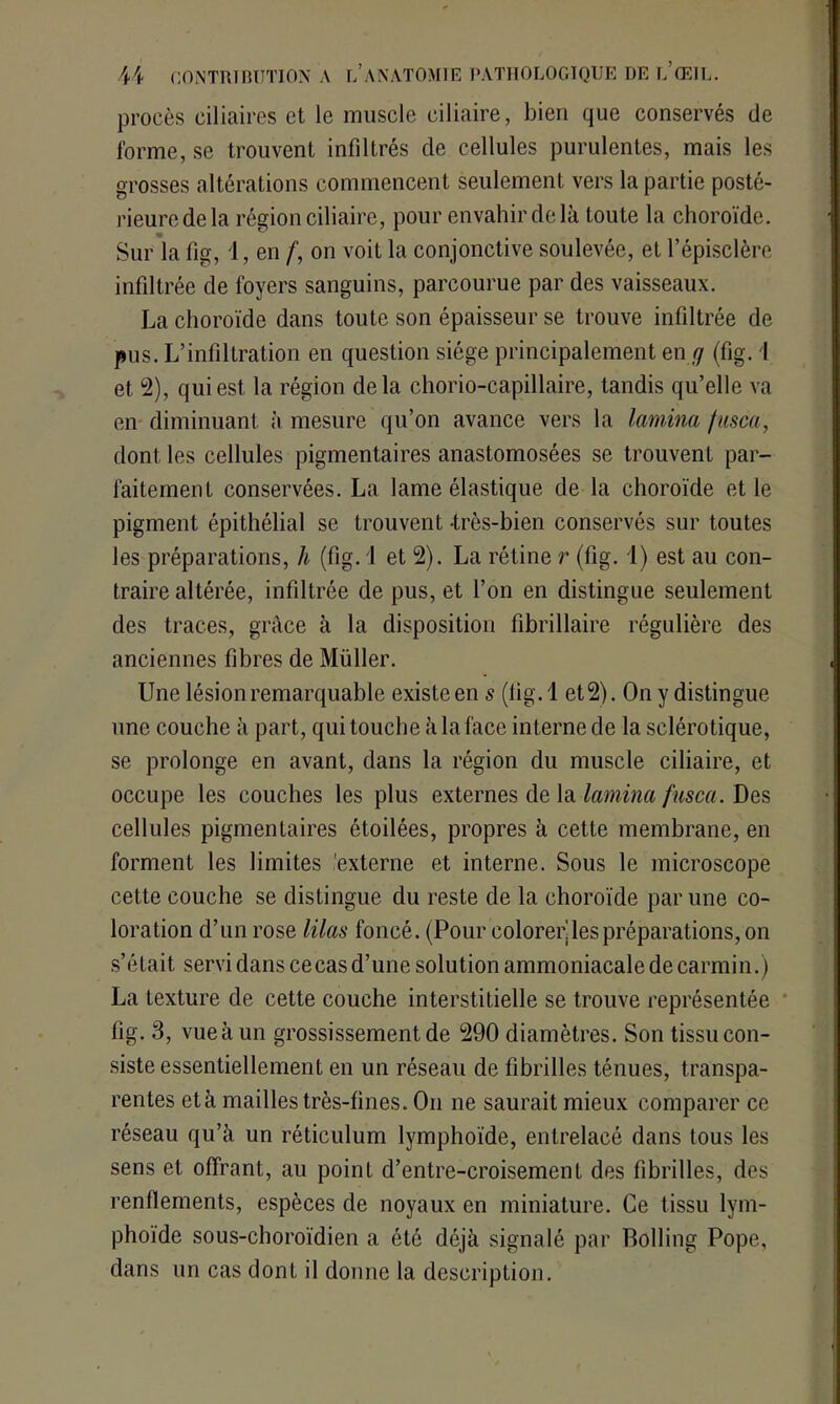 procès ciliaires et le muscle ciliaire, bien que conservés de forme, se trouvent infiltrés de cellules purulentes, mais les grosses altérations commencent seulement vers la partie posté- rieure de la région ciliaire, pour envahir de là toute la choroïde. Sur la fig, 1, en f, on voit la conjonctive soulevée, et l’épisclère infiltrée de foyers sanguins, parcourue par des vaisseaux. La choroïde dans toute son épaisseur se trouve infiltrée de pus. L’infiltration en question siège principalement en g (fig. I et 2), qui est la région delà chorio-capillaire, tandis qu’elle va en diminuant à mesure qu’on avance vers la lamina fusca, dont les cellules pigmentaires anastomosées se trouvent par- faitement conservées. La lame élastique de la choroïde et le pigment épithélial se trouvent -très-bien conservés sur toutes les préparations, h (fig. J et 2). La rétine r (fig. 1) est au con- traire altérée, infiltrée de pus, et l’on en distingue seulement des traces, grâce à la disposition fibrillaire régulière des anciennes fibres de Millier. Une lésion remarquable existe en s (lig. 1 et 2). On y distingue une couche à part, qui touche à la face interne de la sclérotique, se prolonge en avant, dans la région du muscle ciliaire, et occupe les couches les plus externes de la lamina fusca. Des cellules pigmentaires étoilées, propres à cette membrane, en forment les limites 'externe et interne. Sous le microscope cette couche se distingue du reste de la choroïde par une co- loration d’un rose lilas foncé. (Pour colorer les préparations, on s’était servi dans cecas d’une solution ammoniacale de carmin.) La texture de cette couche interstitielle se trouve représentée fig. 3, vue à un grossissement de 290 diamètres. Son tissu con- siste essentiellement en un réseau de fibrilles ténues, transpa- rentes età mailles très-fines. On ne saurait mieux comparer ce réseau qu’à un réticulum lymphoïde, entrelacé dans tous les sens et offrant, au point d’entre-croisement des fibrilles, des renflements, espèces de noyaux en miniature. Ce tissu lym- phoïde sous-choroïdien a été déjà signalé par Bolling Pope, dans un cas dont il donne la description.