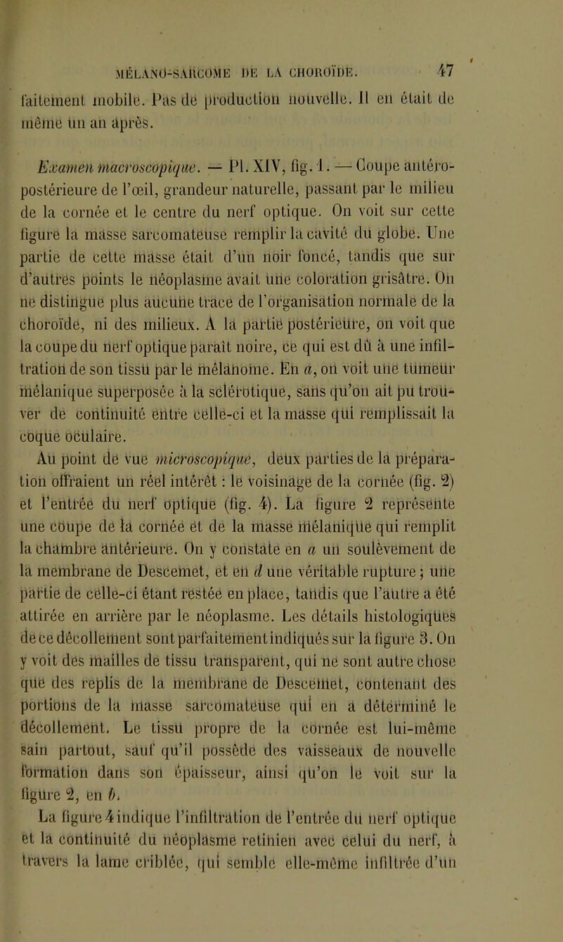faitehient mobile. Pas de pPoductioii nouvelle. Il en était de même Un an après. Examen macroscopique. — PL XIV, fig. 1. — Coupe antéro- postérieure de l’œil, grandeur naturelle, passant par le milieu de la cornée et le centre du nerf optique. On voit sur cette ligure la masse sarcomateuse remplir la cavité du globe. Une partie de cette masse était d’un noir foncé, tandis que sur d’autrës points le néoplasme avait Une coloration grisâtre. On ne distingue plus aucune trace de l’organisation normale de la choroïde, ni des milieux. A la partië postérieure, on voit que la coupe du nerf optique parait noire, ce qui est dû à une infil- tration de son tissu par le mélanome. En a, on voit une ttimeür mélanique superposée à la sclérotique, sans qu’on ait pu trou- ver de continuité entre Celle-ci et la masse qui remplissait la coque oculaire. Au point de vue microscopique, deux parties de la prépara- tion offraient un réel intérêt : le voisinage de la cornée (fig. 2) et l’entrée du nerf optique (fig. 4). La figure 2 représente une coupe de la cornée et de la masse mélaniqUe qui remplit la chambre antérieure. On y constate en a un soulèvement de la membrane de Descemet, et eil d une véritable rupture ; une partie de celle-ci étant restée en place, tandis que l’autre a été attirée en arrière par le néoplasme. Les détails histologiques de ce décollement sont parfaitement indiqués sur la ligure 8. On y voit des mailles de tissu transparent, qui ne sont autre chose que des replis de la membrane de Descërtiet, contenant des portions de la masse sarcomateuse qüi en a déterminé le décollement. Le tissü propre de la cornée est lui-même sain partout, sauf qu’il possède des vaisseaux de nouvelle formation dans sort épaisseur, ainsi qti’on le voit sur la figure 2, en lu La figure4indique l’infiltration de l’entrée du nerf optique et la contihuité du néoplasme rétinien avec celui du nerf, à travers la lame criblée, qui semble elle-même infiltrée d’un