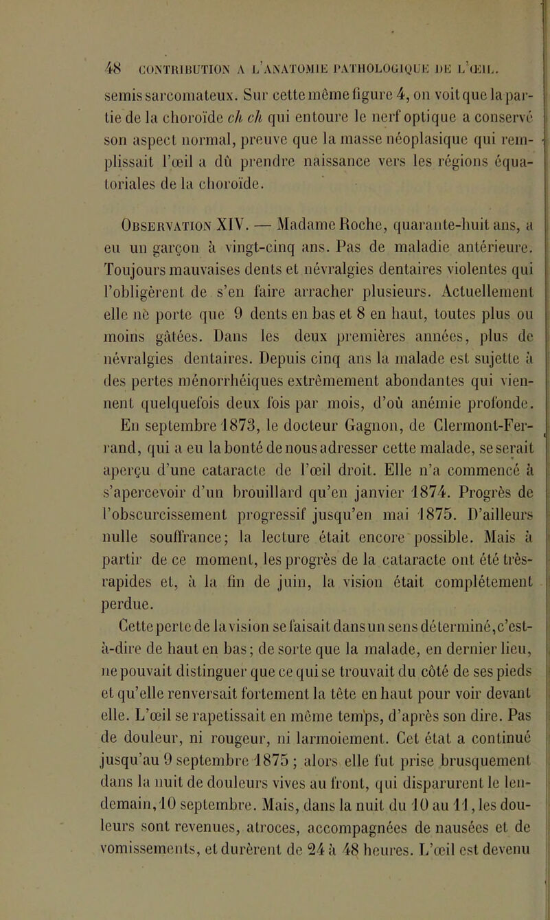 semis sarcomateux. Sur cette meme figure 4, ou voit que la par- tie de la choroïde ch ch qui entoure le nerf optique a conservé son aspect normal, preuve que la masse néoplasique qui rem- plissait l’œil a dû prendre naissance vers les régions équa- toriales de la choroïde. Observation XIV. — Madame Roche, quarante-huit ans, a eu un garçon à vingt-cinq ans. Pas de maladie antérieure. Toujours mauvaises dents et névralgies dentaires violentes qui l’obligèrent de s’en faire arracher plusieurs. Actuellement elle né porte que 9 dents en bas et 8 en haut, toutes plus ou moins gâtées. Dans les deux premières années, plus de névralgies dentaires. Depuis cinq ans la malade est sujette à des pertes ménorrhéiques extrêmement abondantes qui vien- nent quelquefois deux fois par mois, d’où anémie profonde. En septembre 1873, le docteur Gagnon, de Clermont-Fer- rand, qui a eu la bonté de nous adresser cette malade, se serait aperçu d’une cataracte de l’œil droit. Elle n’a commencé à s’apercevoir d’un brouillard qu’en janvier 1874. Progrès de l’obscurcissement progressif jusqu’en mai 1875. D’ailleurs nulle souffrance; la lecture était encore possible. Mais à partir de ce moment, les progrès de la cataracte ont été très- rapides et, à la fin de juin, la vision était complètement perdue. Cette perte de la vision se faisait dans un sens déterminé,c’est- à-dire de haut en bas; de sorte que la malade, en dernier lieu, ne pouvait distinguer que ce qui se trouvait du côté de ses pieds et qu’elle renversait fortement la tête en haut pour voir devant elle. L’œil se rapetissait en même temps, d’après son dire. Pas de douleur, ni rougeur, ni larmoiement. Cet état a continué jusqu’au 9 septembre 1875 ; alors elle fut prise brusquement dans la nuit de douleurs vives au front, qui disparurent le len- demain, 10 septembre. Mais, dans la nuit du 10 au 11, les dou- leurs sont revenues, atroces, accompagnées de nausées et de vomissements, et durèrent de 24 à 48 heures. L’œil est devenu