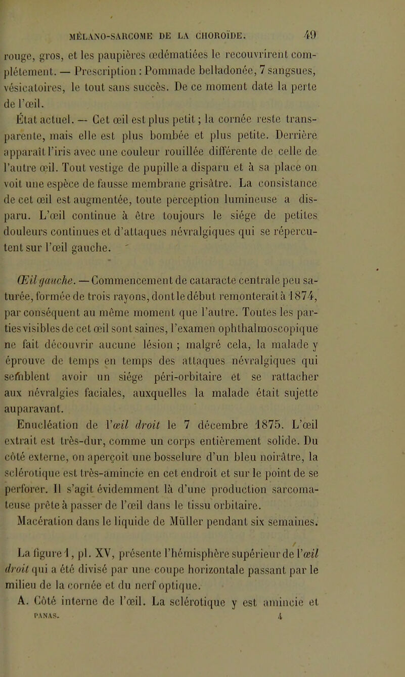 rouge, gros, et les paupières œdématiées le recouvrirent com- plètement. — Prescription : Pommade belladonée, 7 sangsues, vésicatoires, le tout sans succès. De ce moment date la perte de l’œil. État actuel. — Cet œil est plus petit ; la cornée reste trans- parente, mais elle est plus bombée et plus petite. Derrière apparaît l’iris avec une couleur rouillée différente de celle de l’autre œil. Tout vestige de pupille a disparu et à sa place on voit une espèce de fausse membrane grisâtre. La consistance de cet œil est augmentée, toute perception lumineuse a dis- paru. L’œil continue à être toujours le siège de petites douleurs continues et d’attaques névralgiques qui se répercu- tent sur l’œil gauche. ' Œil gauche. —Commencement de caiaracte centrale peu sa- turée, formée de trois rayons, dont le début remonterait à 1874, par conséquent au même moment que l’autre. Toutes les par- ties visibles de cet œil sont saines, l’examen ophthalmoscopique ne fait découvrir aucune lésion ; malgré cela, la malade y éprouve de temps en temps des attaques névralgiques qui semblent avoir un siège péri-orbitaire et se rattacher aux névralgies faciales, auxquelles la malade était sujette auparavant. Enucléation de Y œil droit le 7 décembre 1875. L’œil extrait est très-dur, comme un corps entièrement solide. Du coté externe, on aperçoit une bosselure d’un bleu noirâtre, la sclérotique est très-amincie en cet endroit et sur le point de se perforer. Il s’agit évidemment là d’une production sarcoma- teuse prête à passer de l’œil dans le tissu orbitaire. Macération dans le liquide de Muller pendant six semaines. La figure!, pi. XV, présente l’hémisphère supérieur de Y œil droit <pii a été divisé par une coupe horizontale passant par le milieu de la cornée et du nerf optique. A. Côté interne de l’œil. La sclérotique y est amincie et PANAS. 4