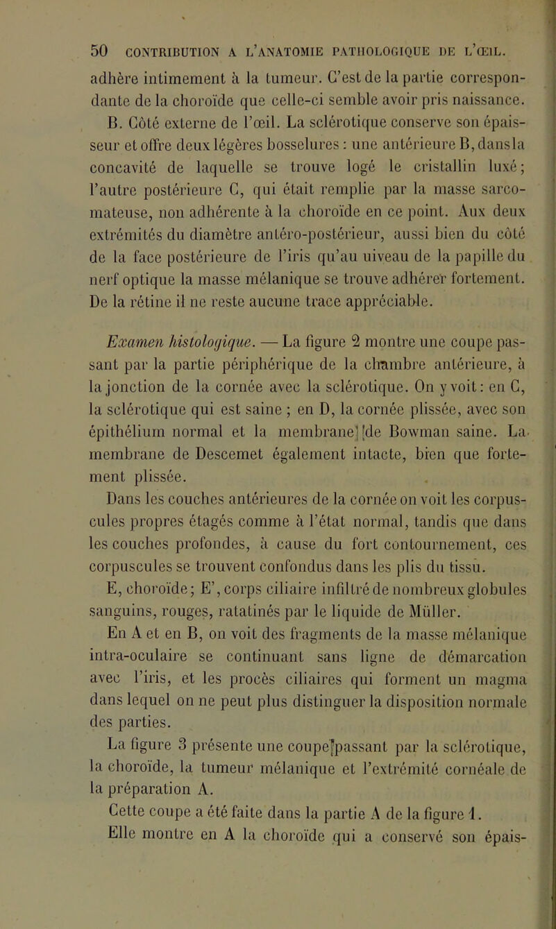 adhère intimement h la tumeur. C’est de la partie correspon- dante de la choroïde que celle-ci semble avoir pris naissance. B. Côté externe de l’œil. La sclérotique conserve son épais- seur et offre deux légères bosselures : une antérieure B, dansla concavité de laquelle se trouve logé le cristallin luxé; l’autre postérieure C, qui était remplie par la masse sarco- mateuse, non adhérente à la choroïde en ce point. Aux deux extrémités du diamètre antéro-postérieur, aussi bien du côté de la face postérieure de l’iris qu’au uiveau de la papille du nerf optique la masse mélanique se trouve adhérer fortement. De la rétine il ne reste aucune trace appréciable. Examen histologique. — La figure 2 montre une coupe pas- sant par la partie périphérique de la chambre antérieure, à la jonction de la cornée avec la sclérotique. On y voit: en C, la sclérotique qui est saine ; en D, la cornée plissée, avec son épithélium normal et la membrane] [de Bowman saine. La. membrane de Descemet également intacte, bien que forte- ment plissée. Dans les couches antérieures de la cornée on voit les corpus- cules propres étagés comme à l’état normal, tandis que dans les couches profondes, à cause du fort contournement, ces corpuscules se trouvent confondus dans les plis du tissu. E, choroïde; E’,corps ciliaire infiltrédenombreuxglobules sanguins, rouges, ratatinés par le liquide de Millier. En A et en B, on voit des fragments de la masse mélanique intra-oculaire se continuant sans ligne de démarcation avec l’iris, et les procès ciliaires qui forment un magma dans lequel on ne peut plus distinguer la disposition normale des parties. La figure 3 présente une coupefpassant par la sclérotique, la choroïde, la tumeur mélanique et l’extrémité cornéale de la préparation A. Cette coupe a été faite dans la partie A de la figure 1. Elle montre en A la choroïde qui a conservé son épais-